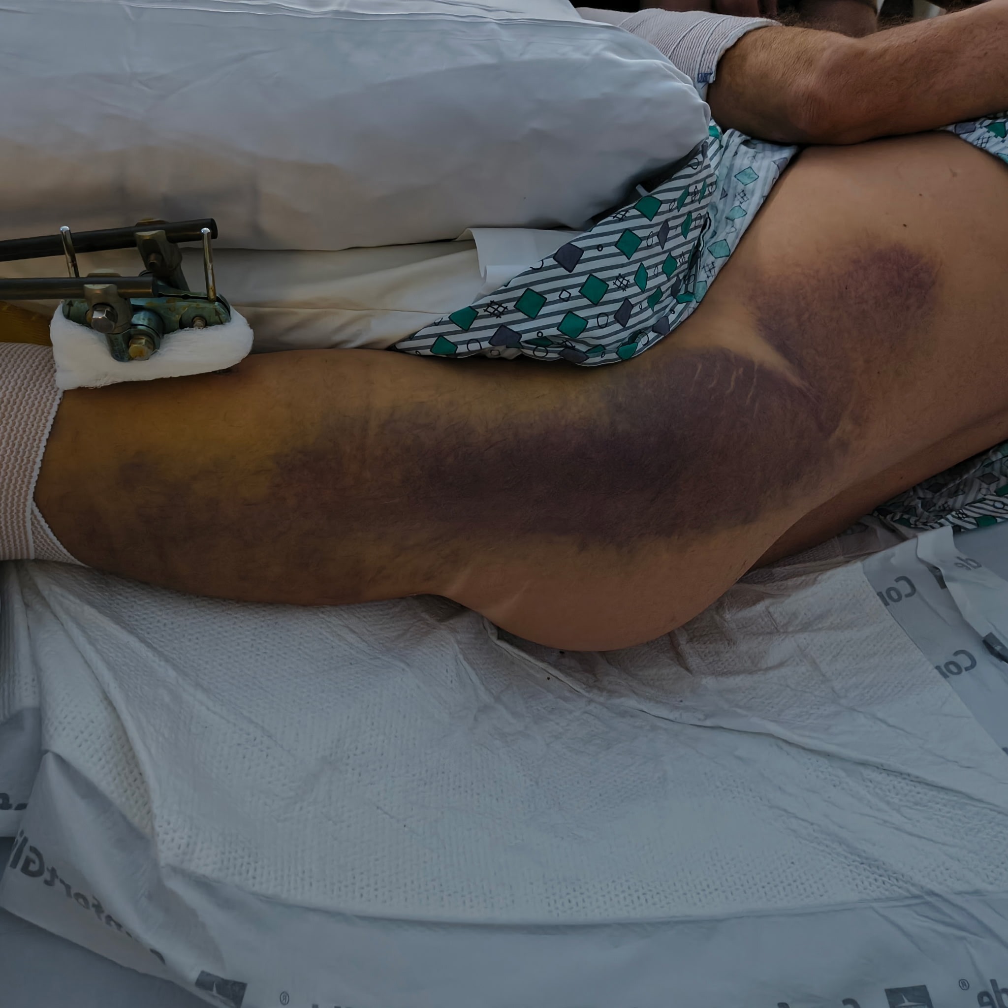 Support Anthony DeCanio’s Recovery campaign photo, 7 of 8
