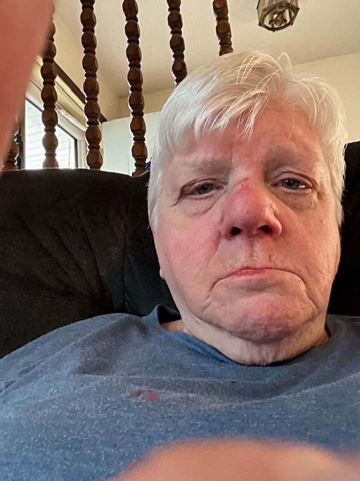 Support for Mom's Recovery After Birthday Fall campaign photo, 7 of 7