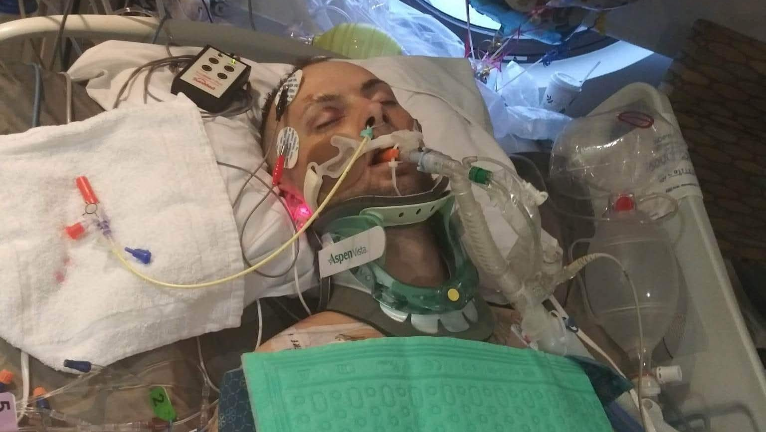 Support Recovery for Motorcycle Accident Victim photo