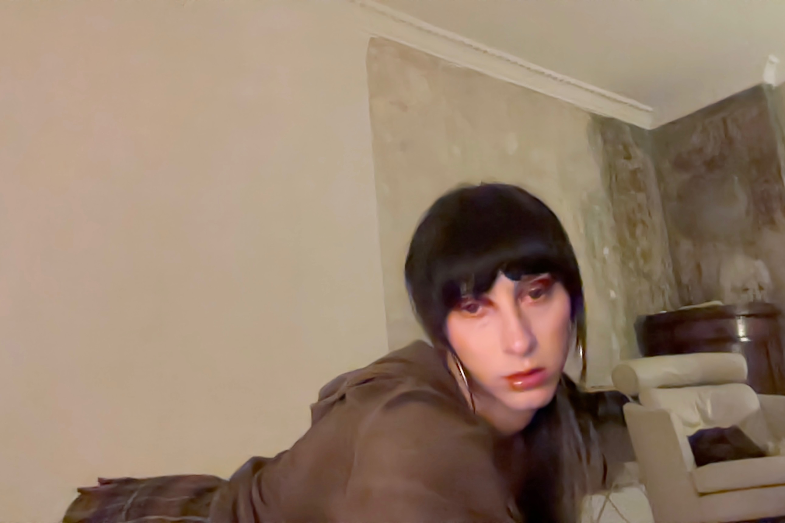 Nicky’s Facial Feminization Surgery campaign photo, 4 of 5