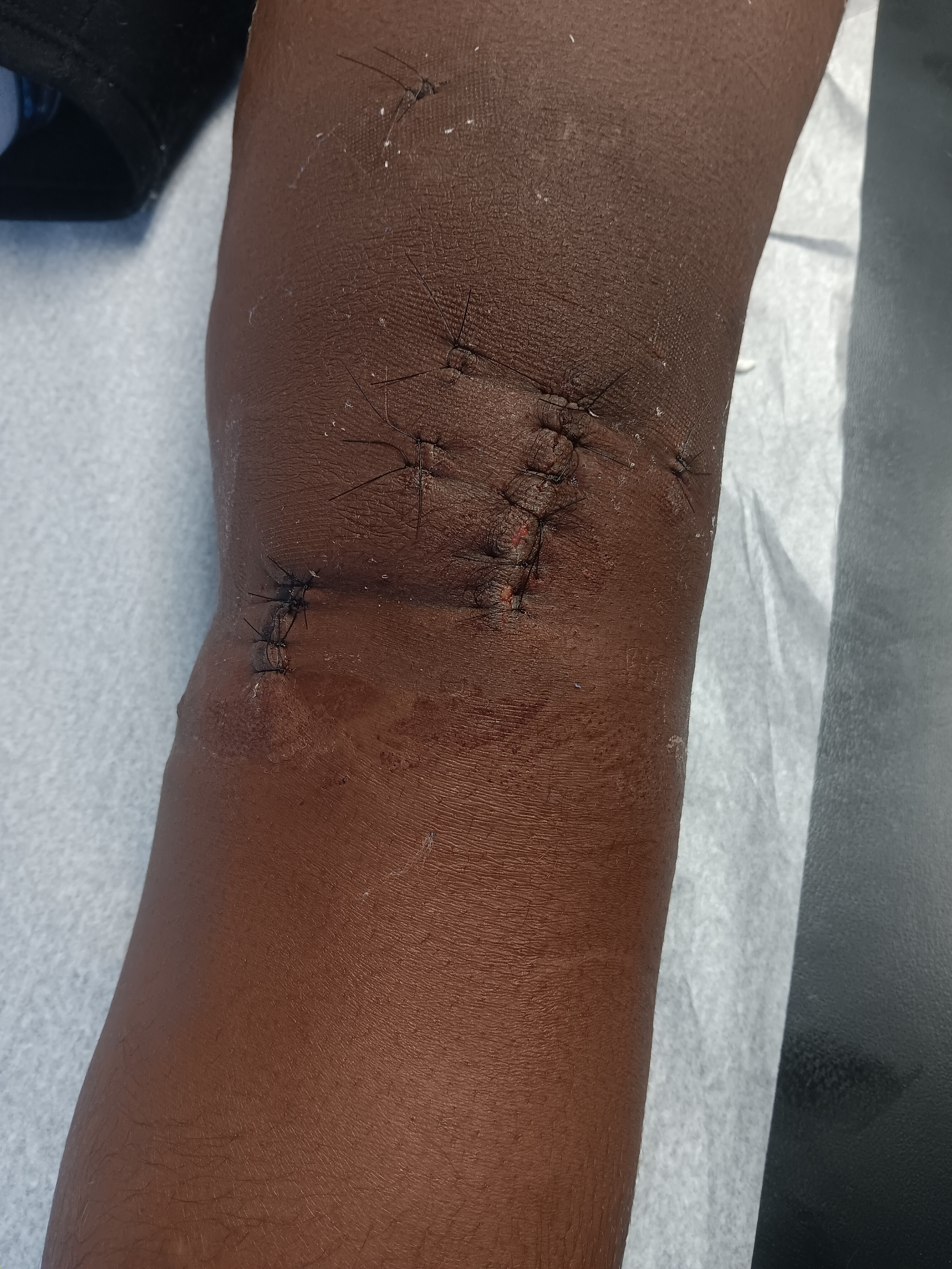 Help AJ Recover from ACL Surgery !! campaign photo, 6 of 8