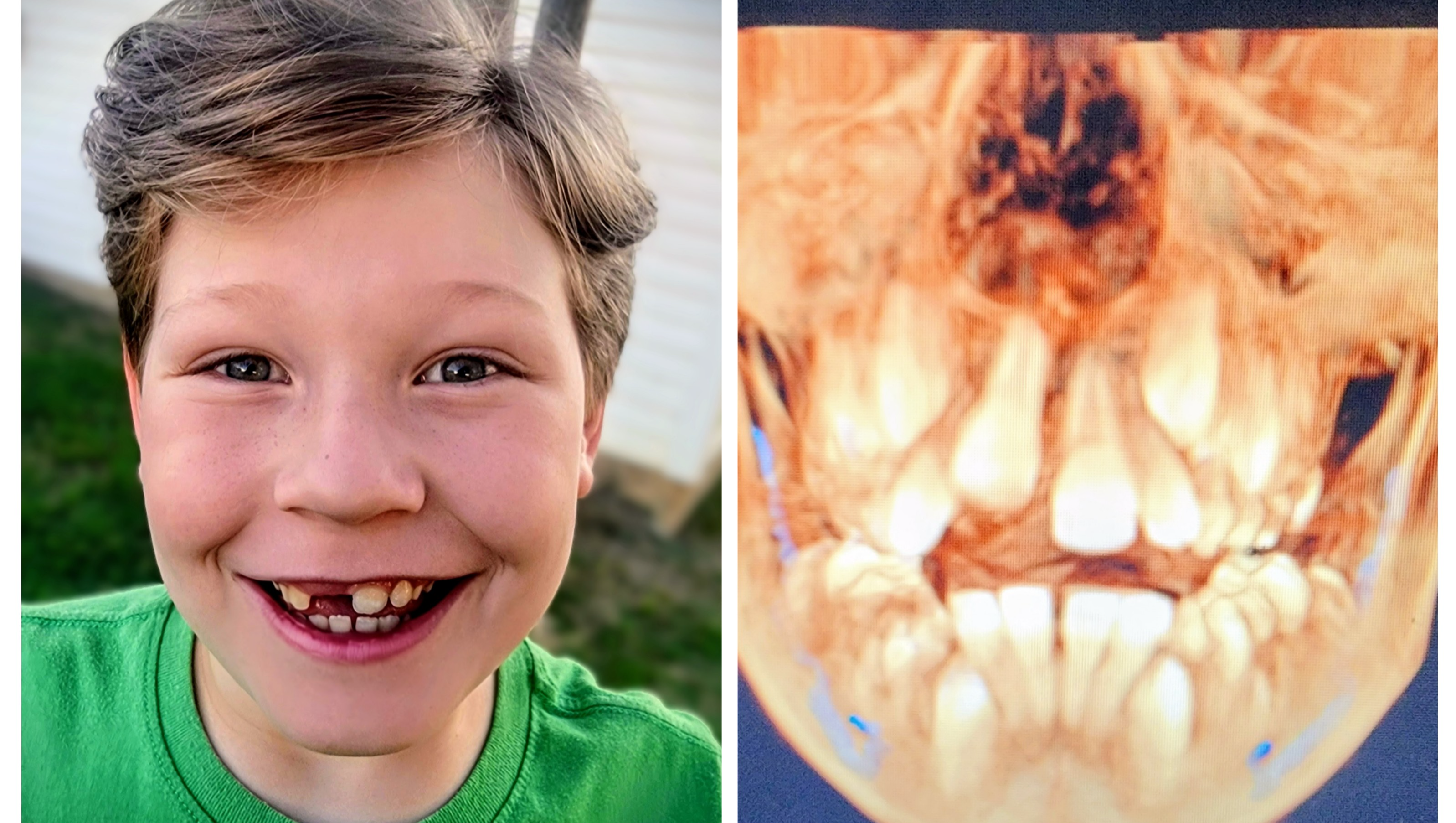 Alex's Hidden Bucktooth