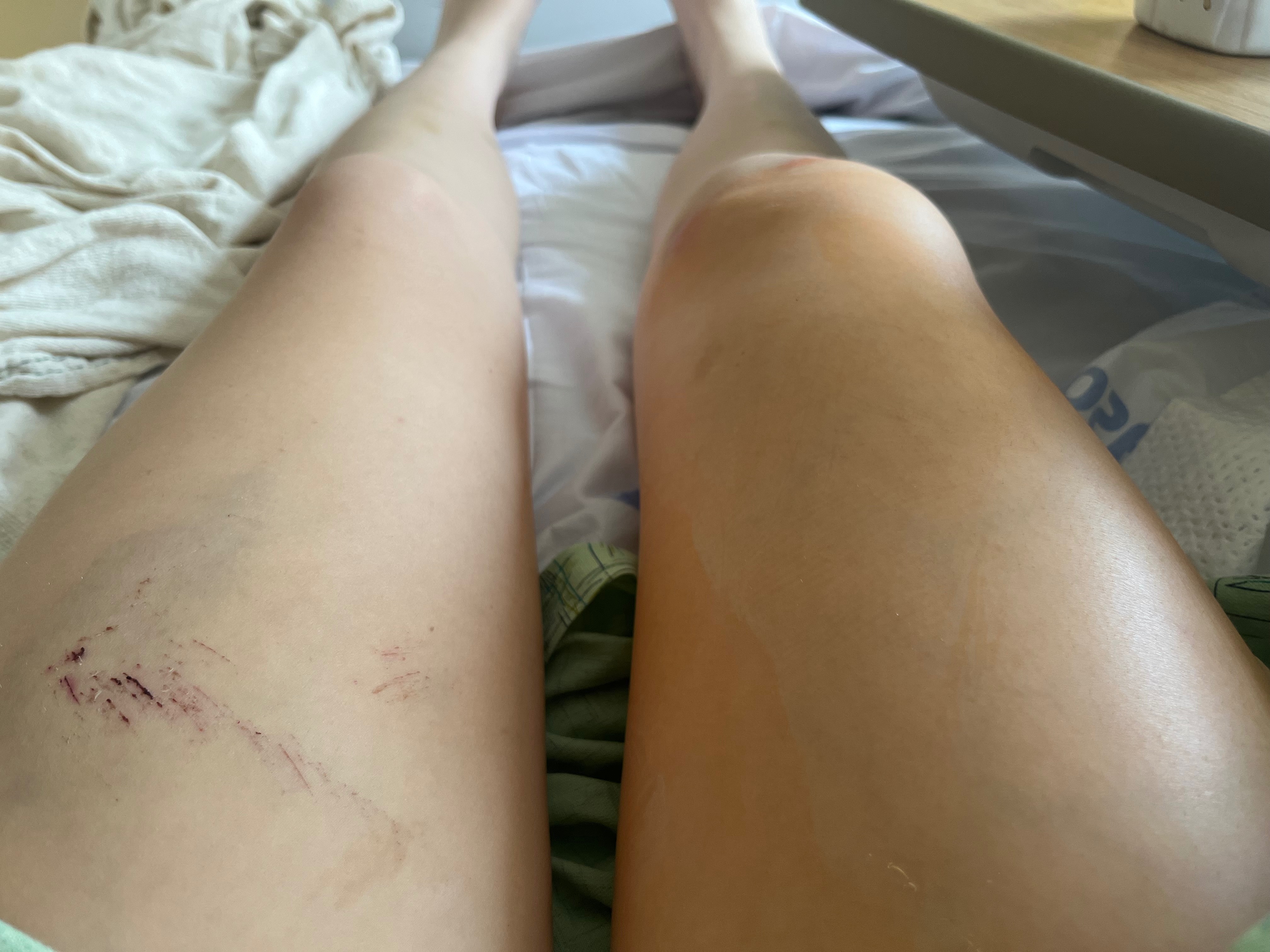 Support Cayley’s Recovery After Bike Accident campaign photo, 7 of 8