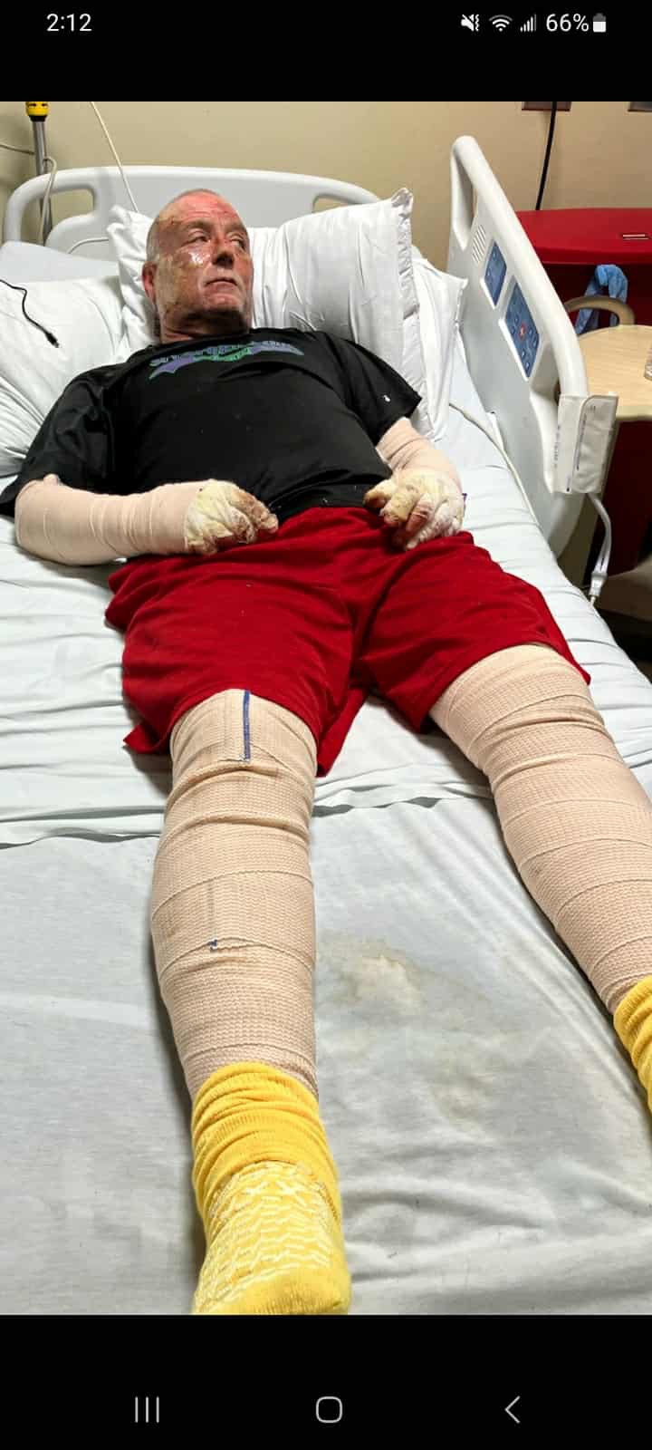 Support Kent's Recovery- House Fire Severe Burns campaign photo, 4 of 8