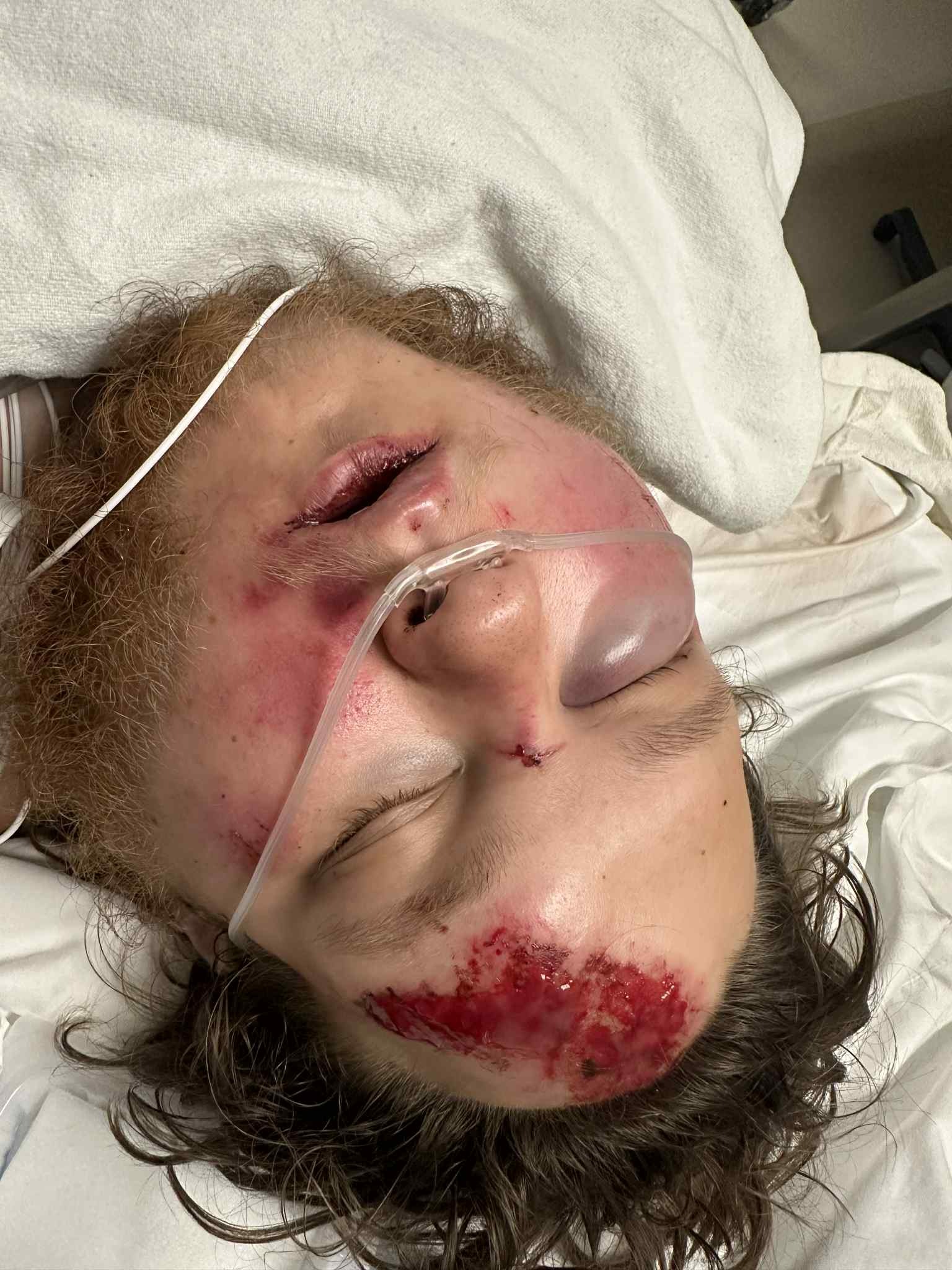 Very bad moped accident. campaign photo, 2 of 4