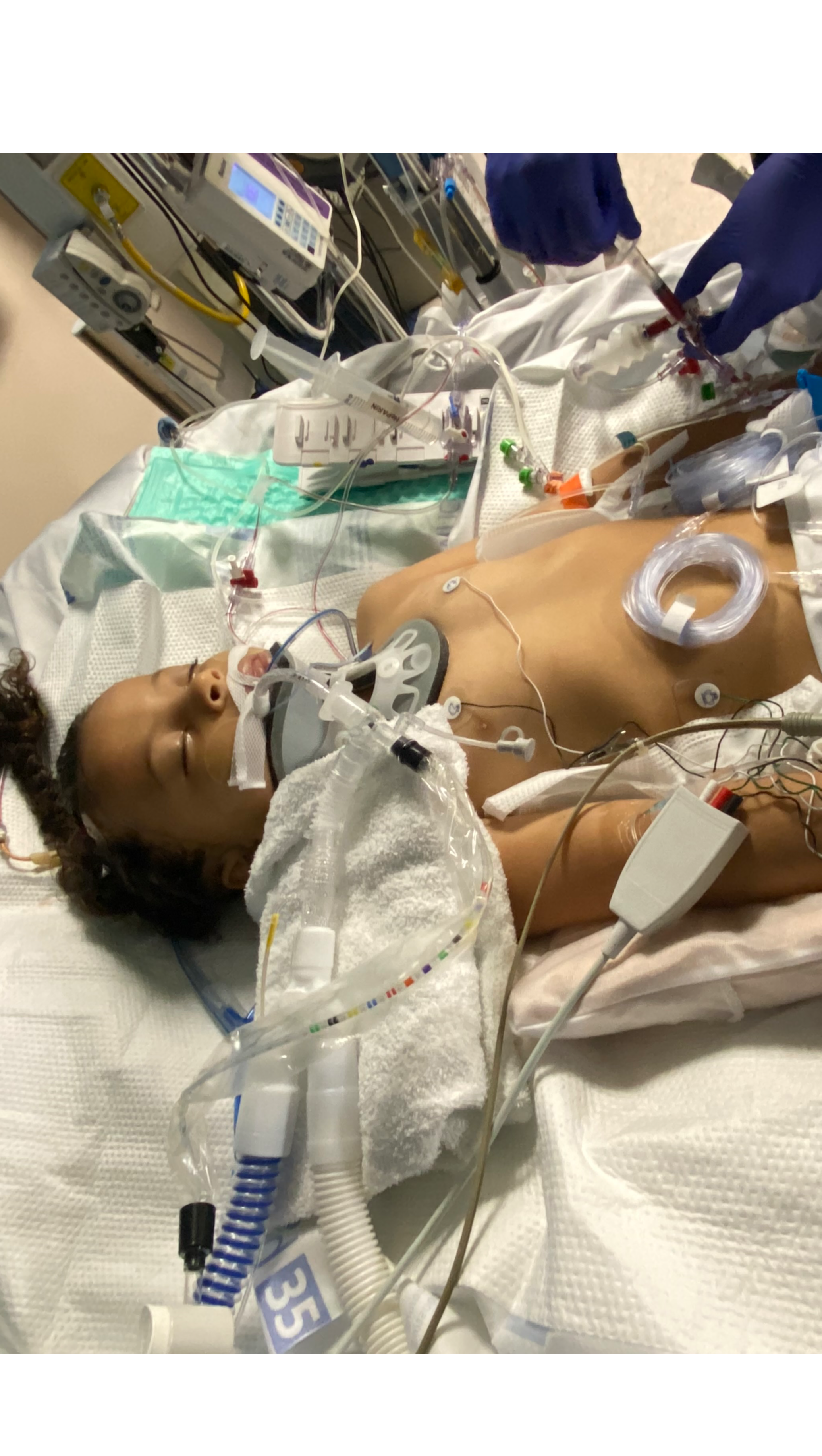Candy Rooks Fundraiser by Candy Mathews : Help Support Alayah & Family After Tragic ...