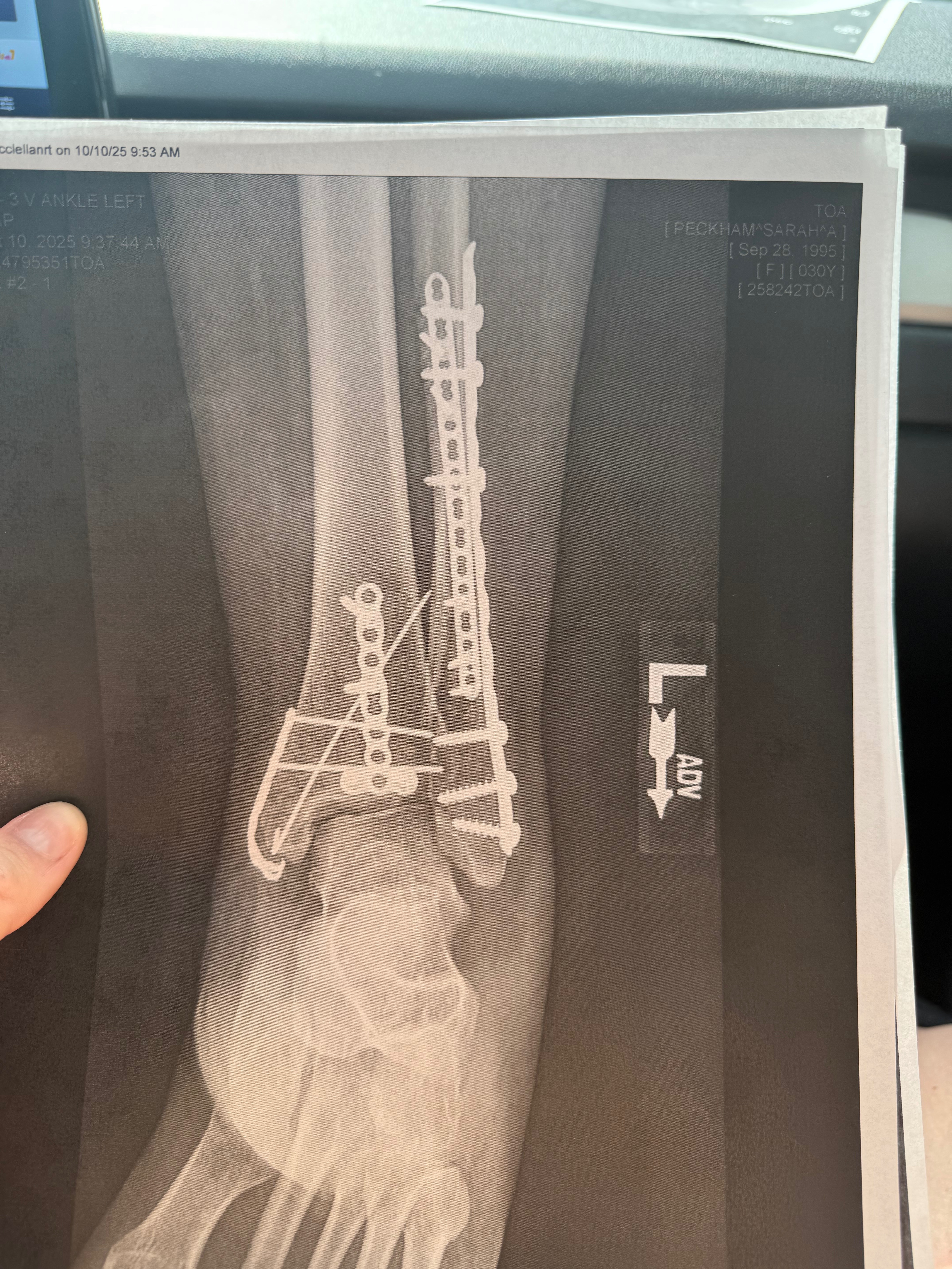 Help : monthly & medical campaign photo, 4 of 6