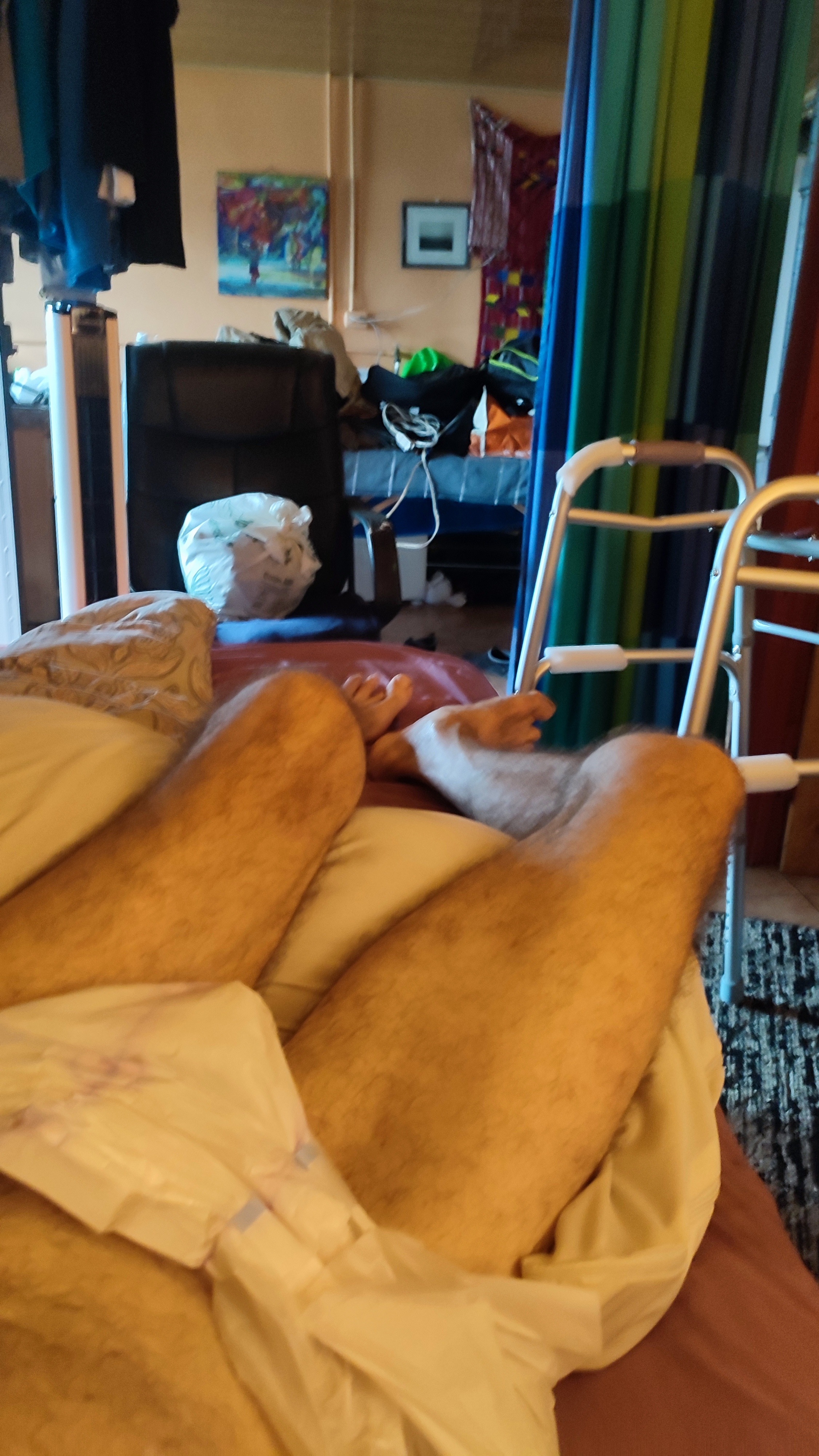 Hip repair gone wrong.I need help. Fractured pelvis repair. campaign photo, 2 of 6