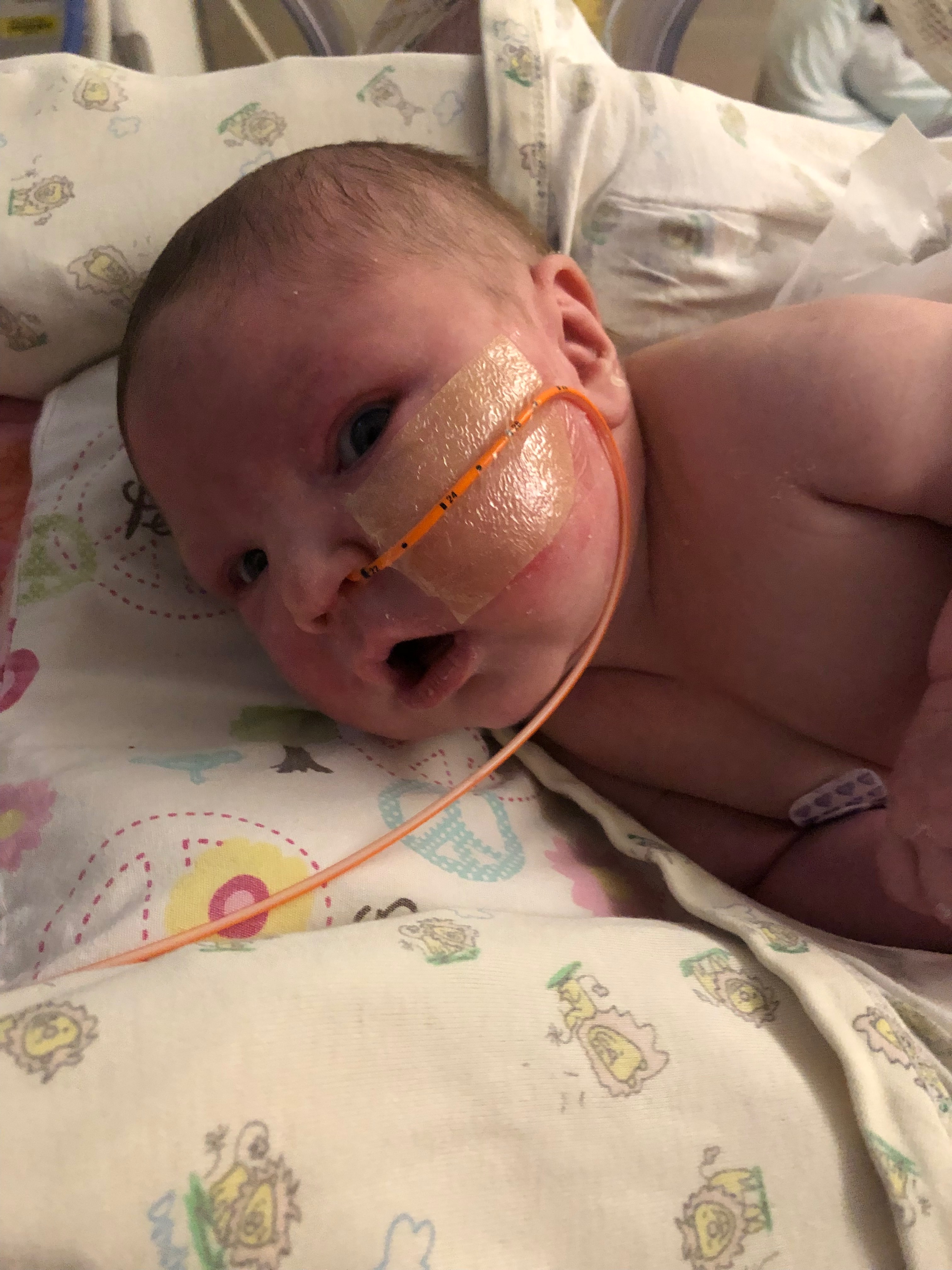 Help Support Baby Jemimah’s Journey With Spina Bifida campaign photo, 4 of 8