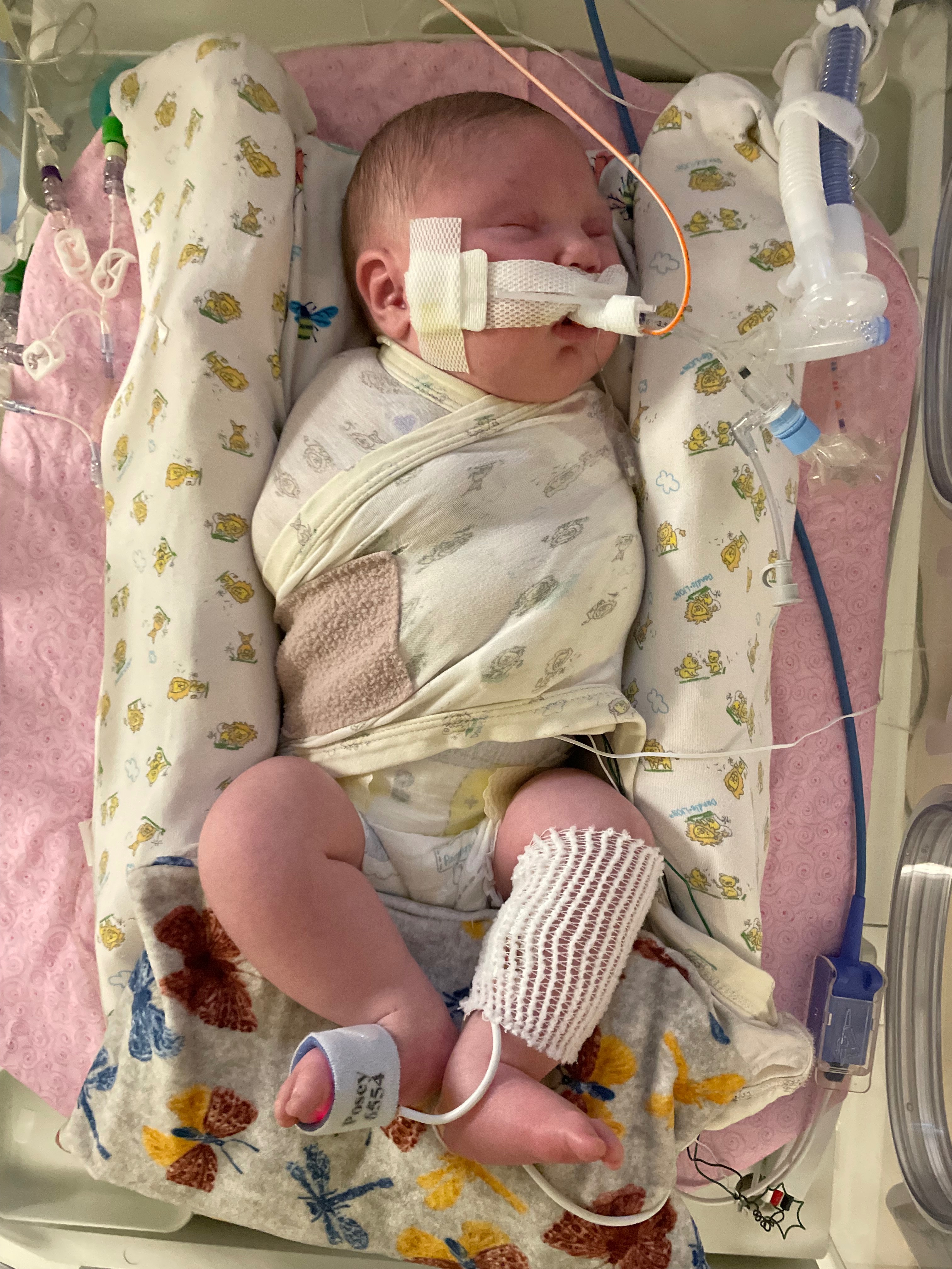Help Support Baby Jemimah’s Journey With Spina Bifida campaign photo, 5 of 8