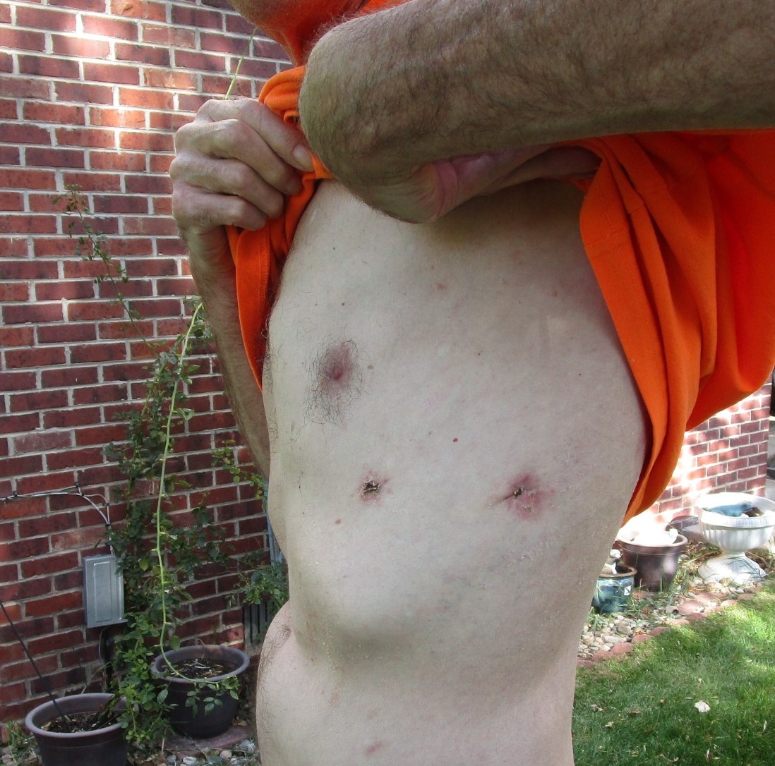 Help with medical expenses. campaign photo, 6 of 7
