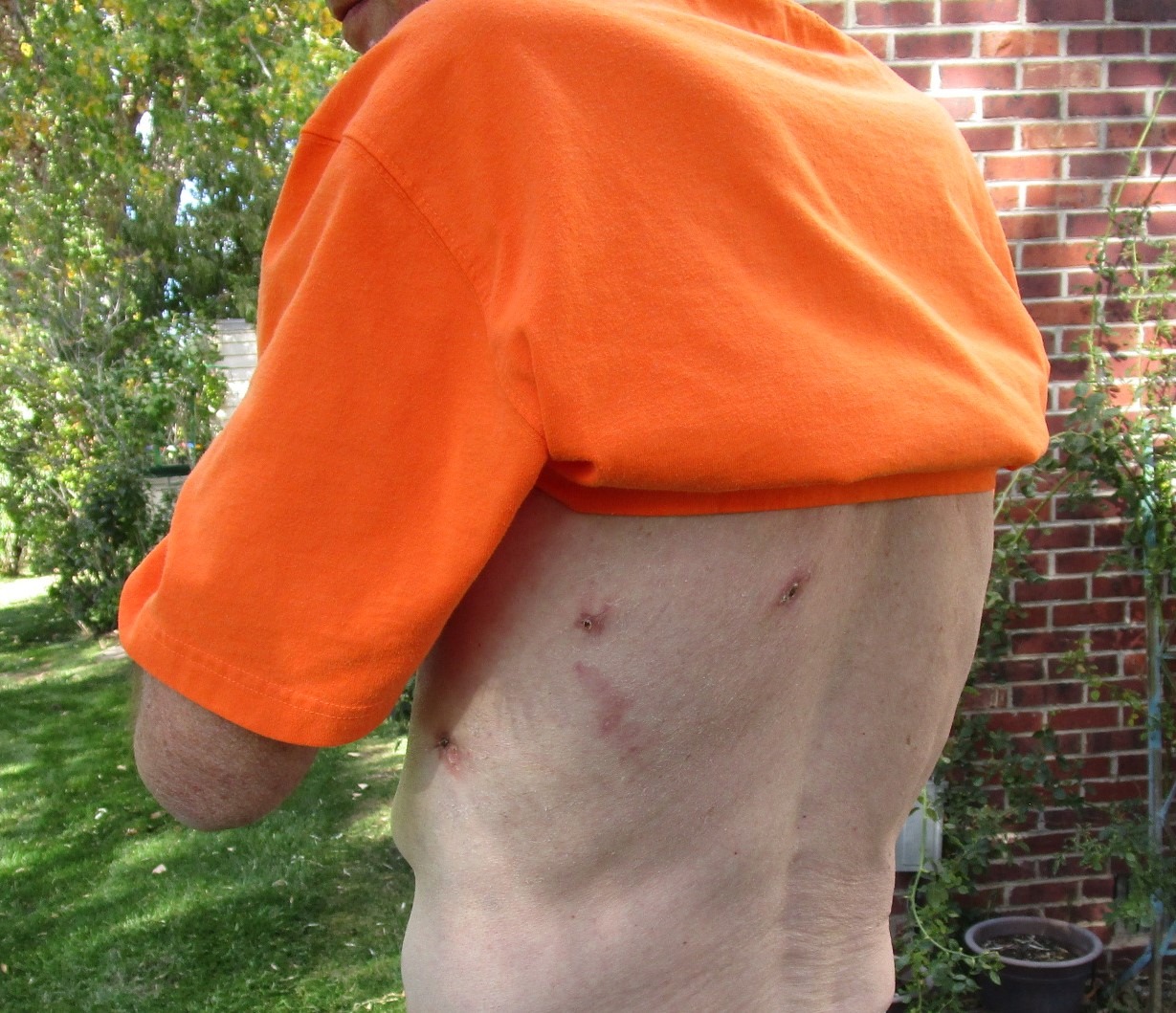 Help with medical expenses. campaign photo, 2 of 7