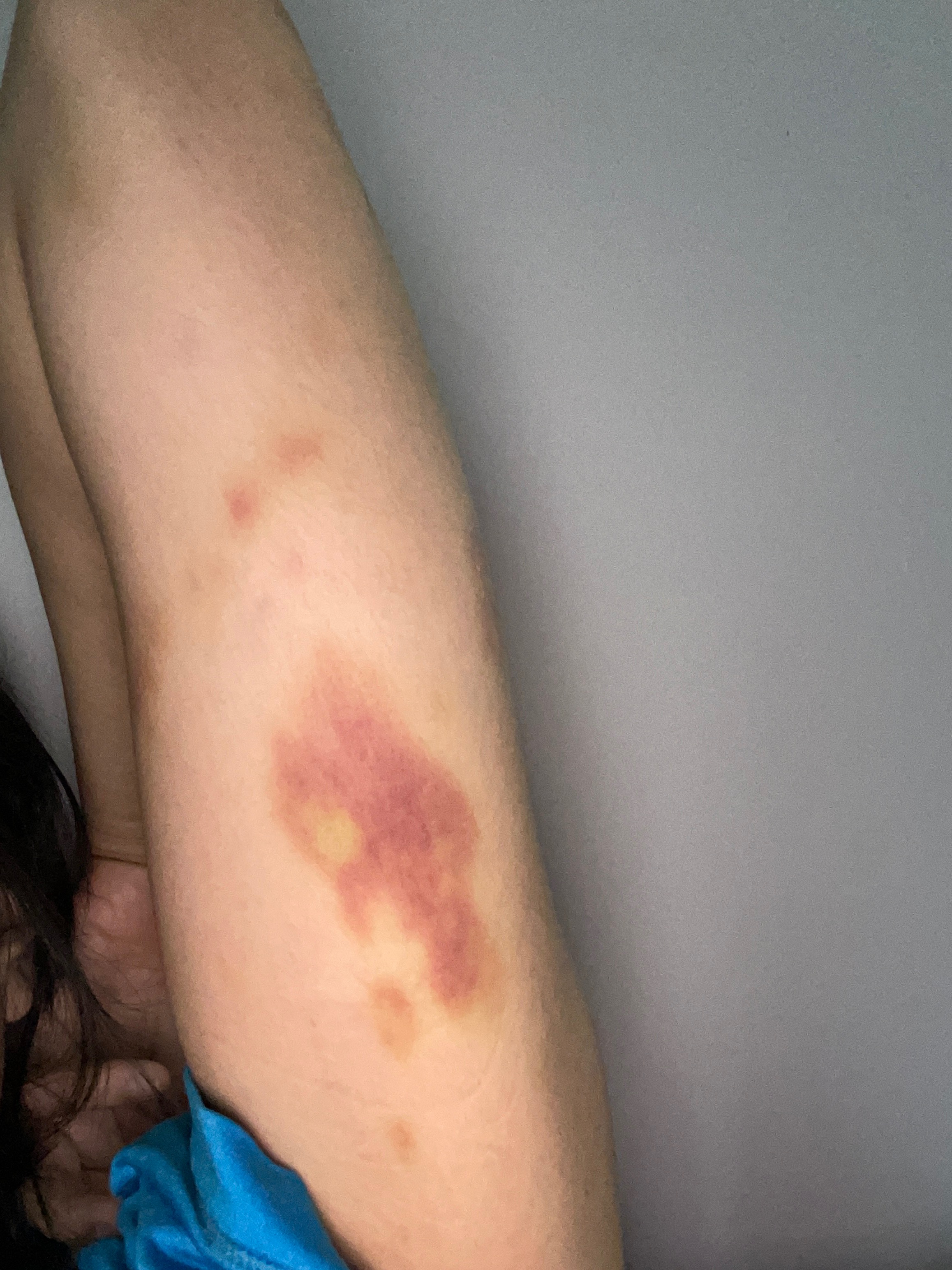 getting out of a domestic violence relationship campaign photo, 7 of 8