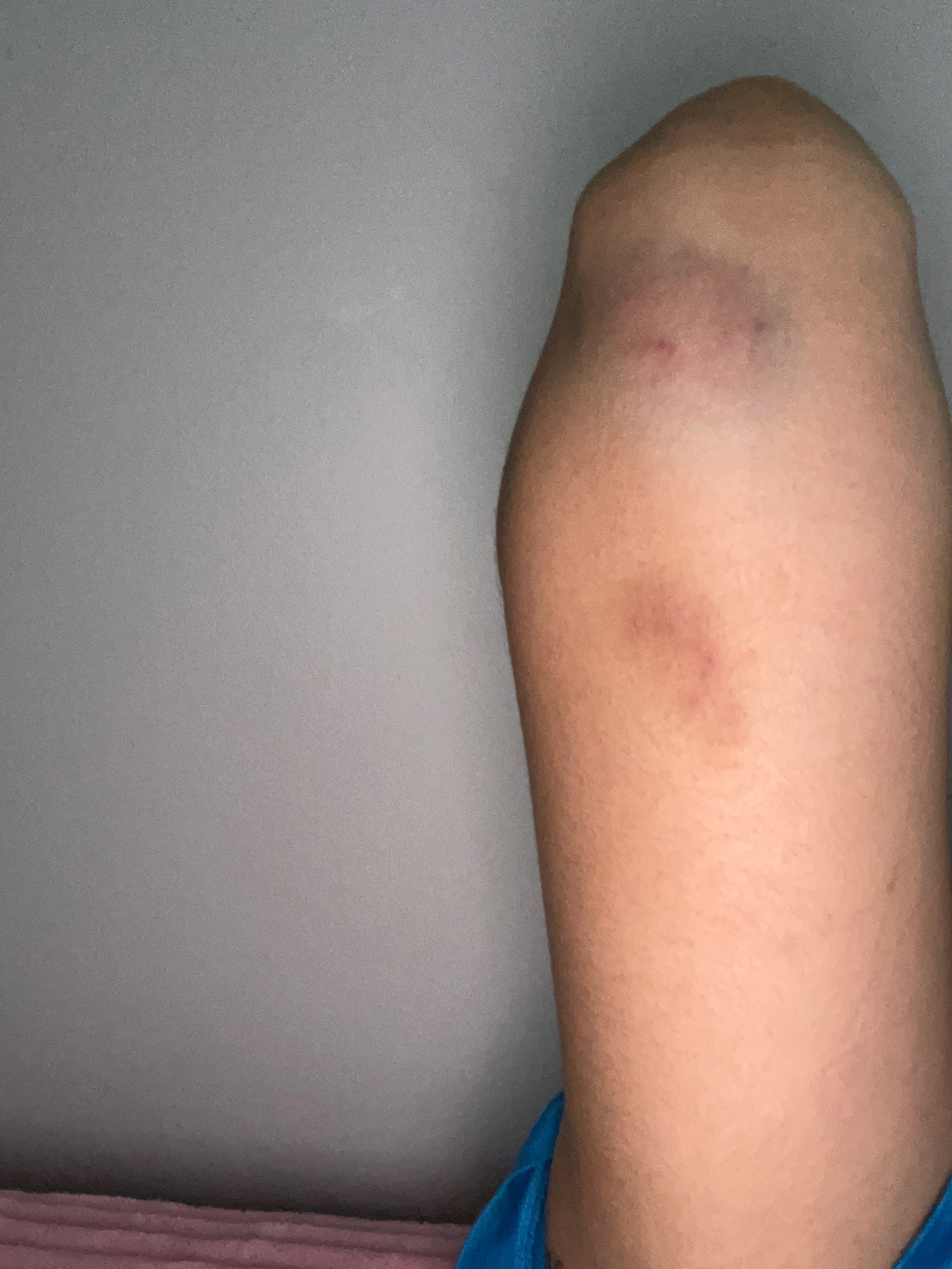 getting out of a domestic violence relationship campaign photo, 5 of 8