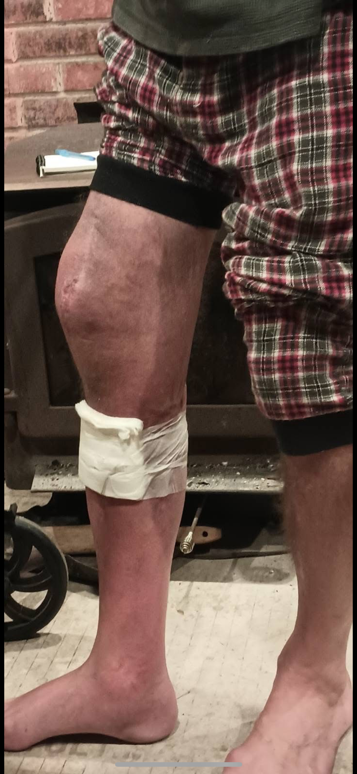 Help Westy handle amputation campaign photo, 2 of 5