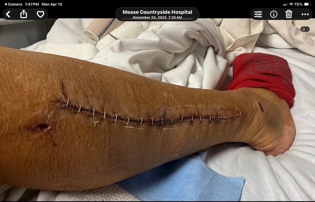 Help Jayne Bennett Get Life-Changing Surgery campaign photo, 4 of 5