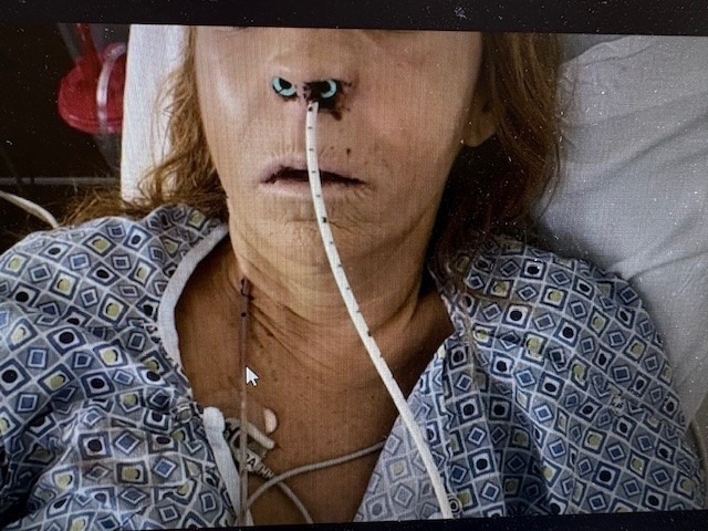 Help Jayne Bennett Get Life-Changing Surgery campaign photo, 2 of 5