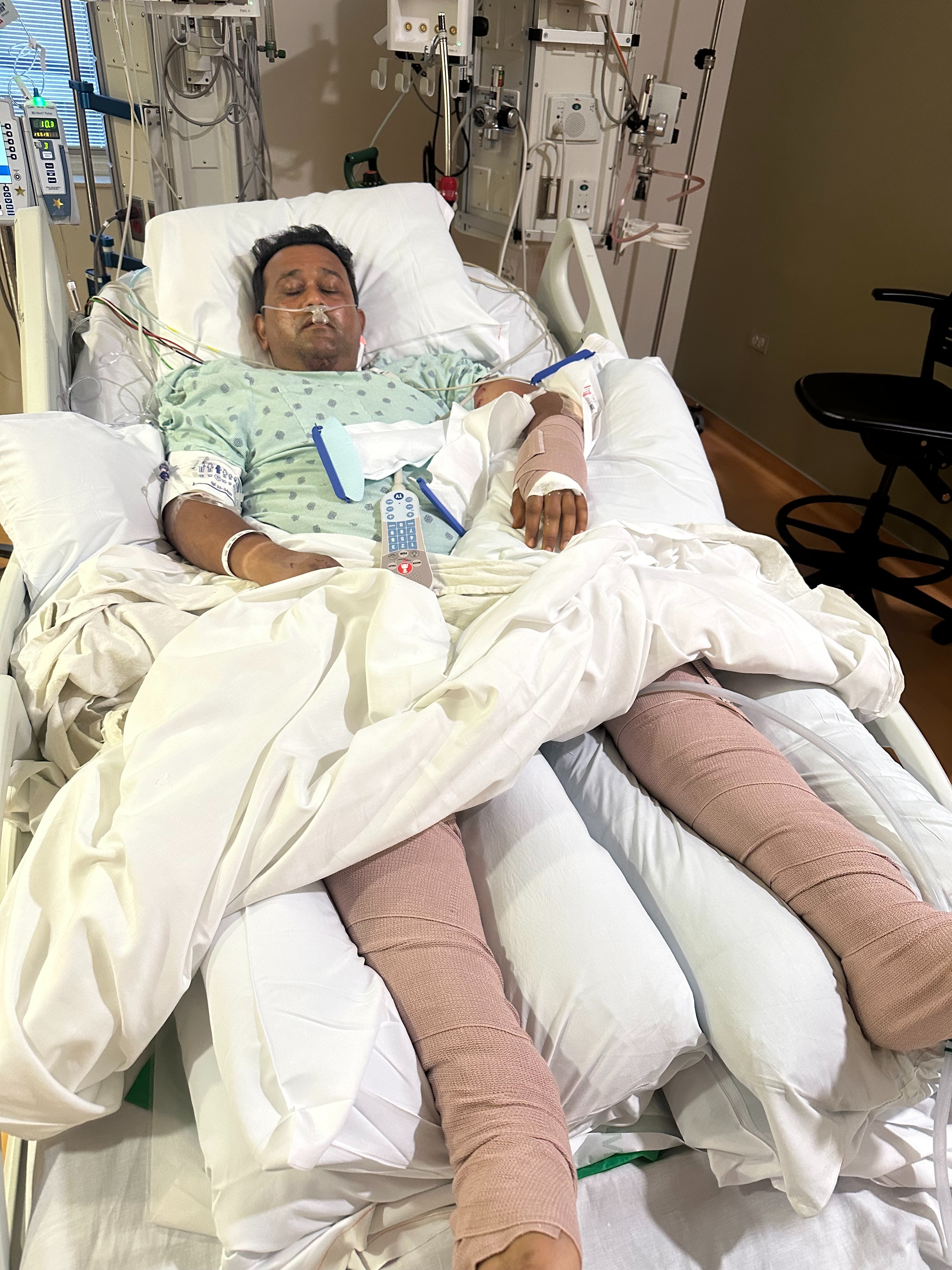 Help Vijay Maisuria Heal After Devastating Accident campaign photo, 2 of 4