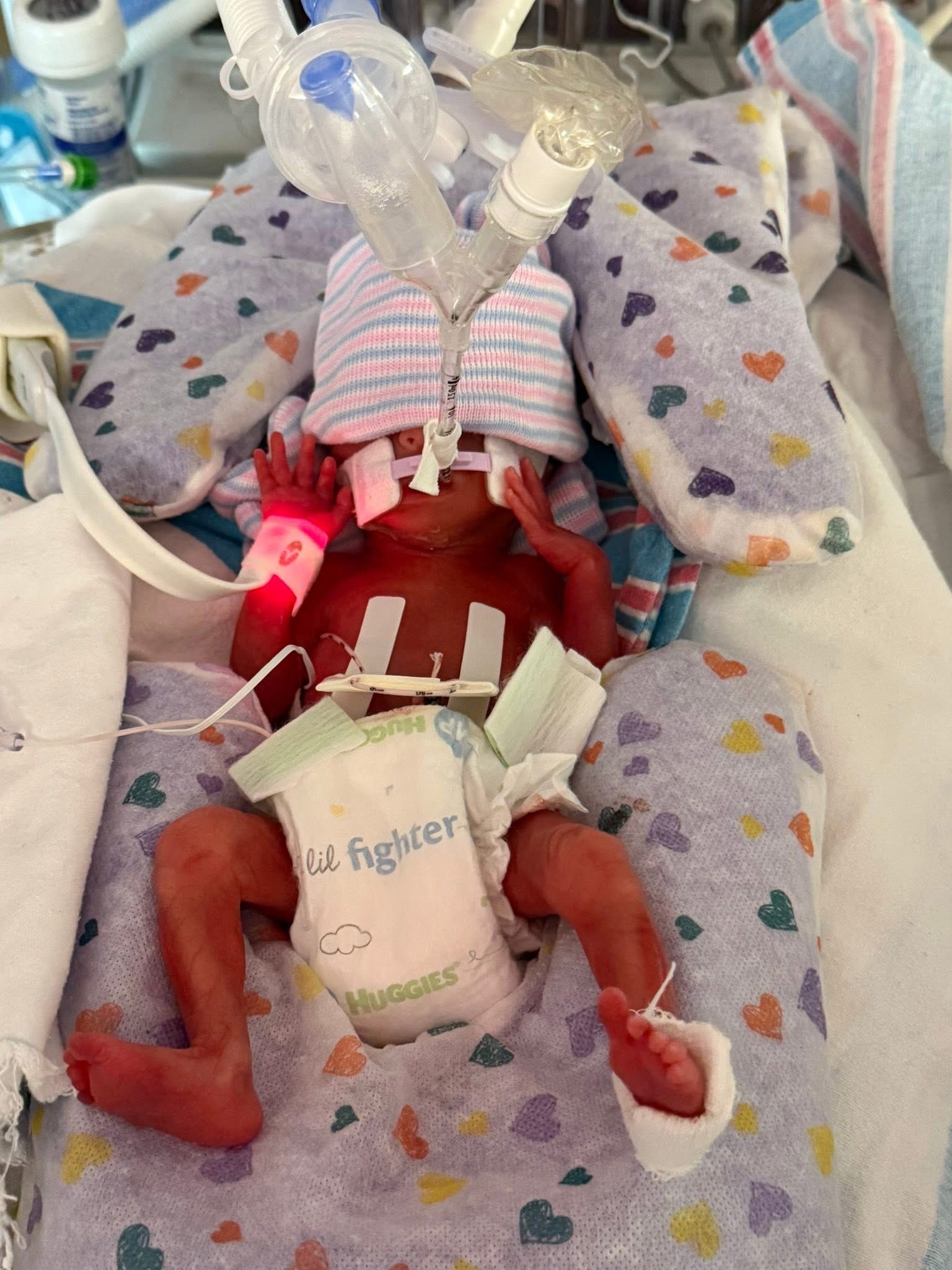 Support Matt, Kaelee, and Baby Willow's NICU Journey campaign photo, 6 of 7