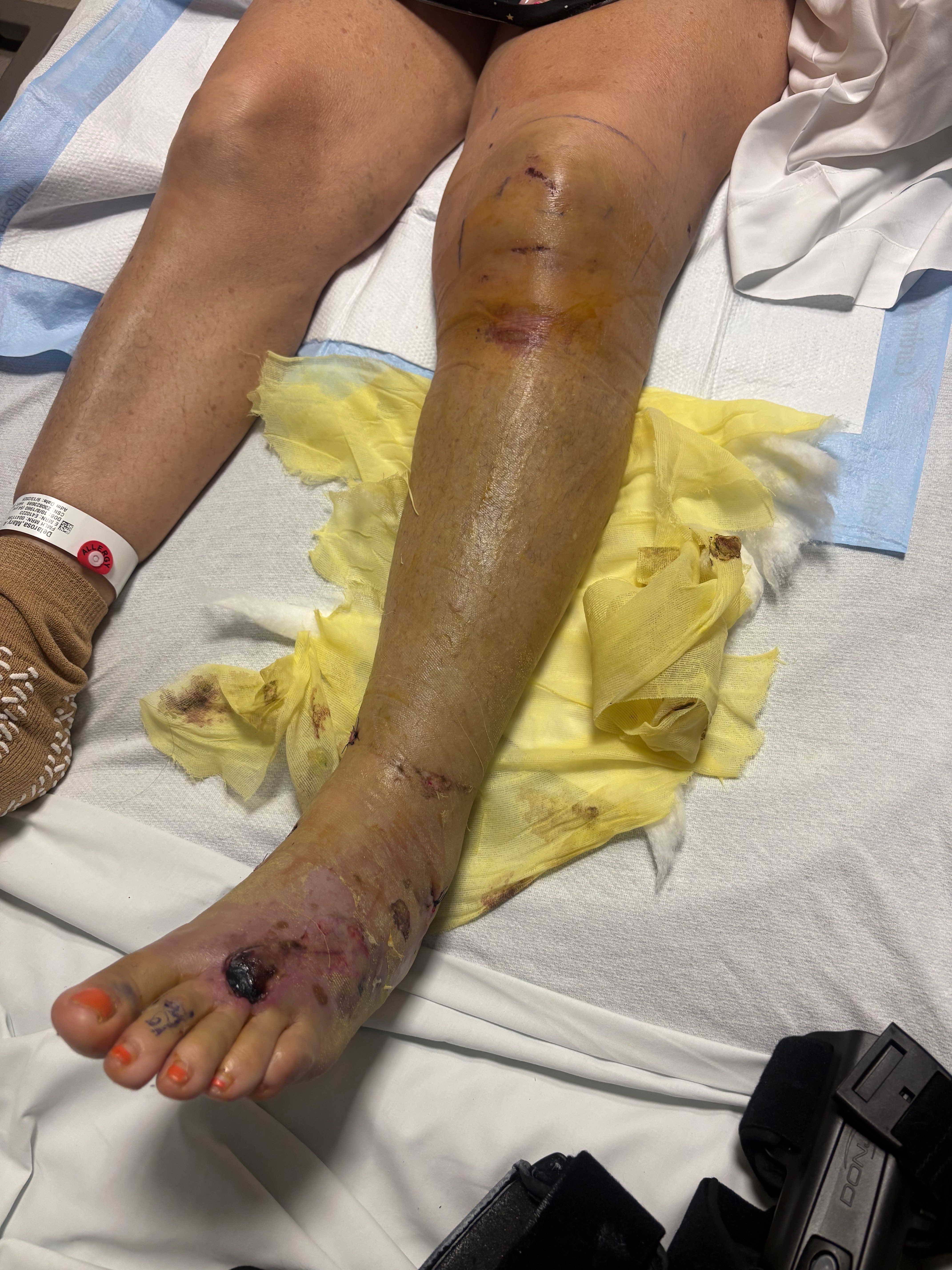 Support after a devastating motorcycle accident campaign photo, 5 of 8