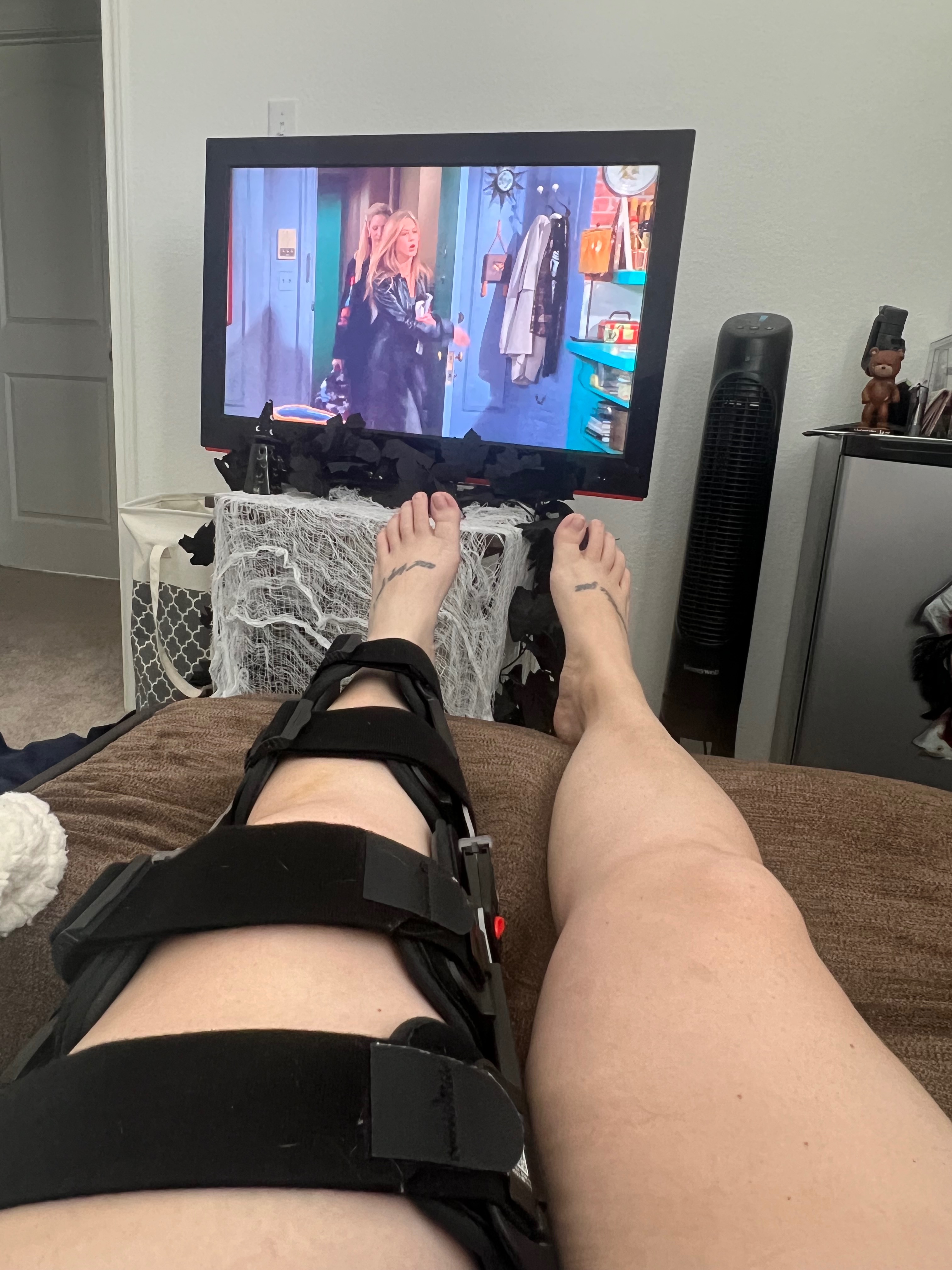 Tibial fracture surgery for Letha Brown campaign photo, 4 of 6