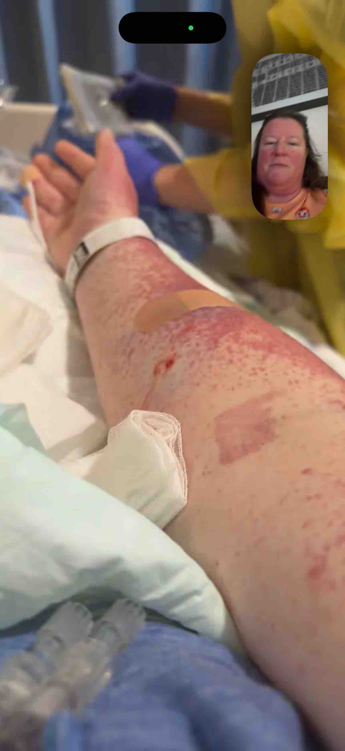 Support Kylee's Battle Against Stage 4 Melanoma campaign photo, 8 of 11