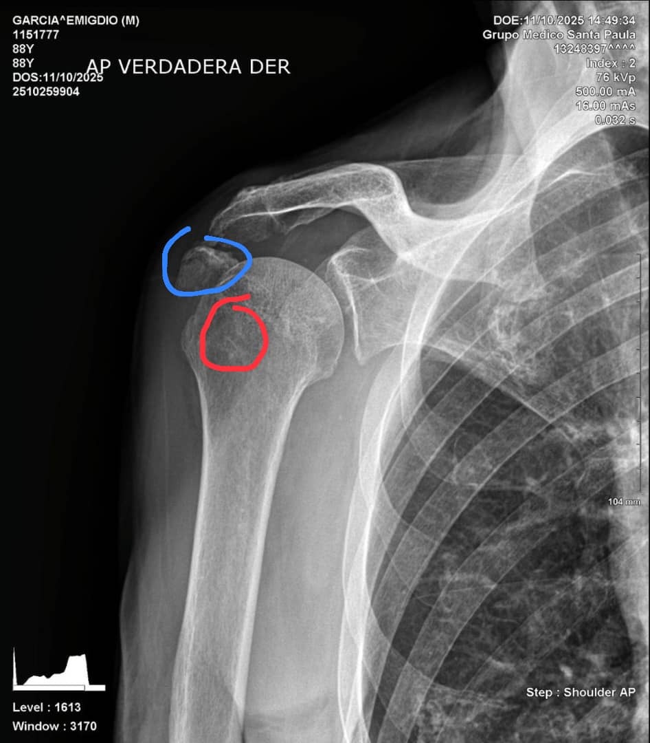 Help Grandpa Emigdio with his shoulder surgery campaign photo, 2 of 8
