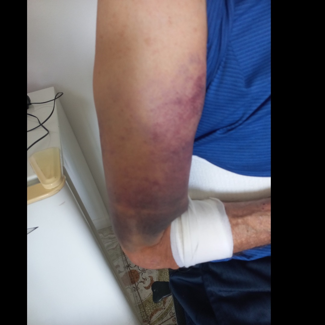 Help Grandpa Emigdio with his shoulder surgery campaign photo, 5 of 8