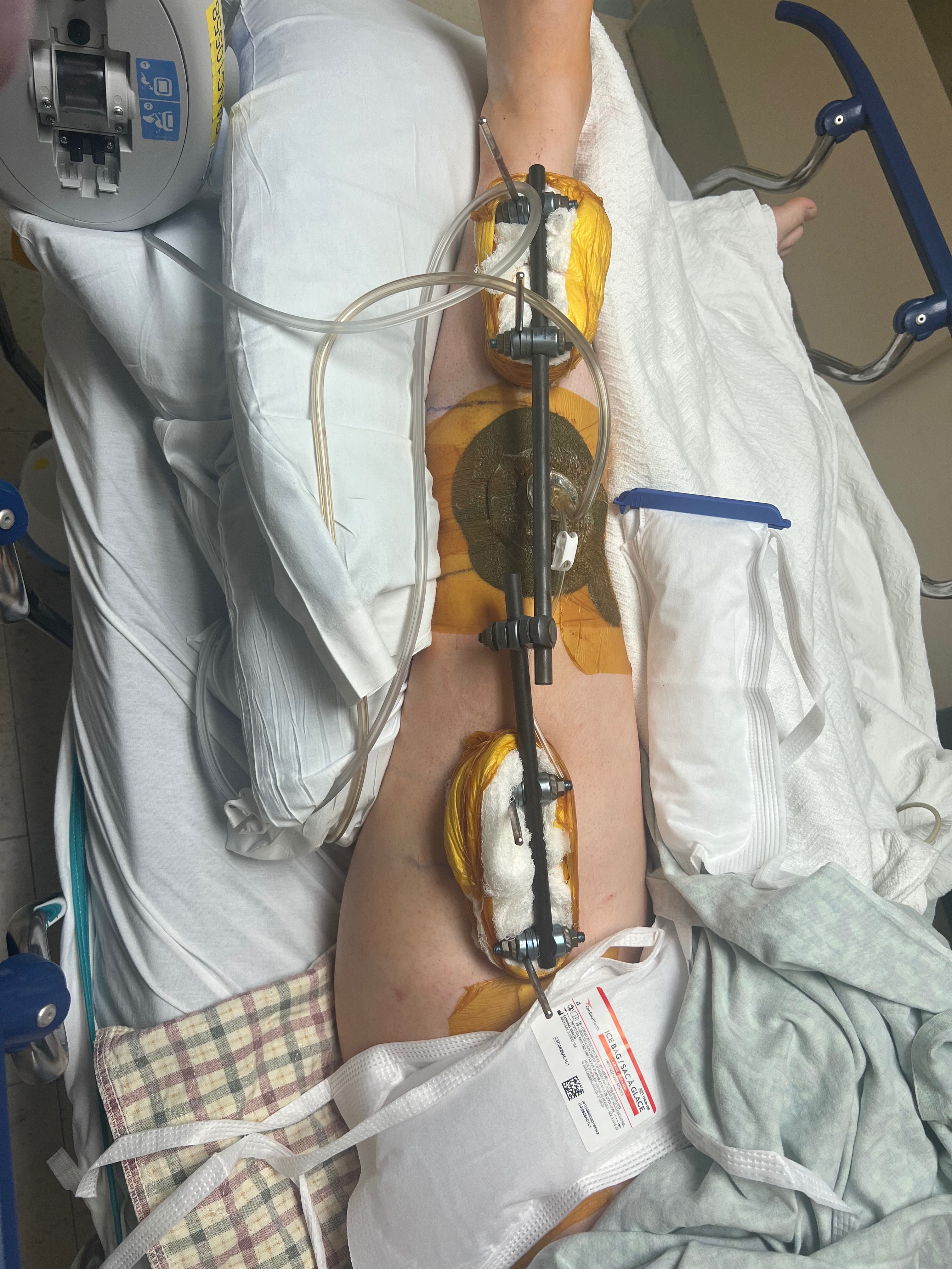 Jake Shurock Accident and Medical Expenses campaign photo, 5 of 7