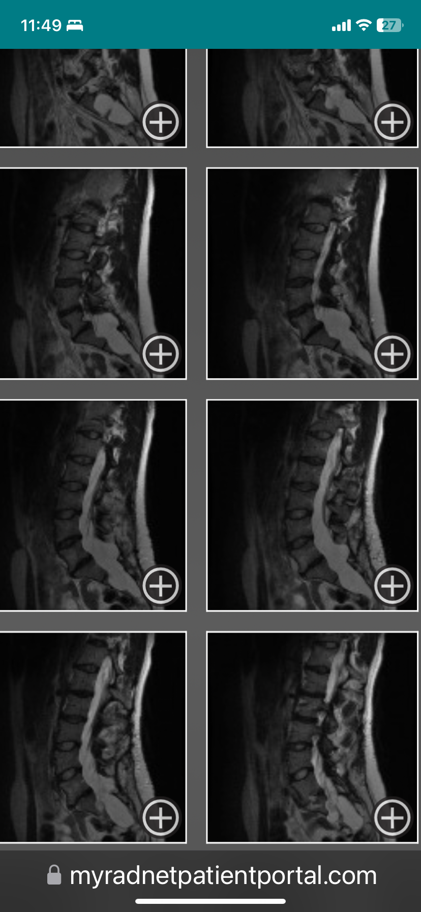 Help Meg afford her MRI and CT scans campaign photo, 2 of 4