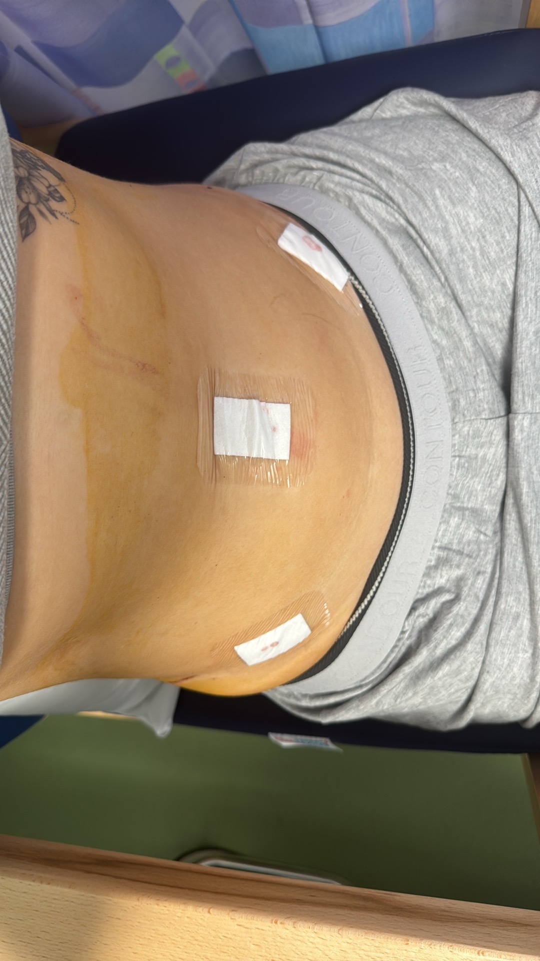 Endo awareness campaign photo, 2 of 6