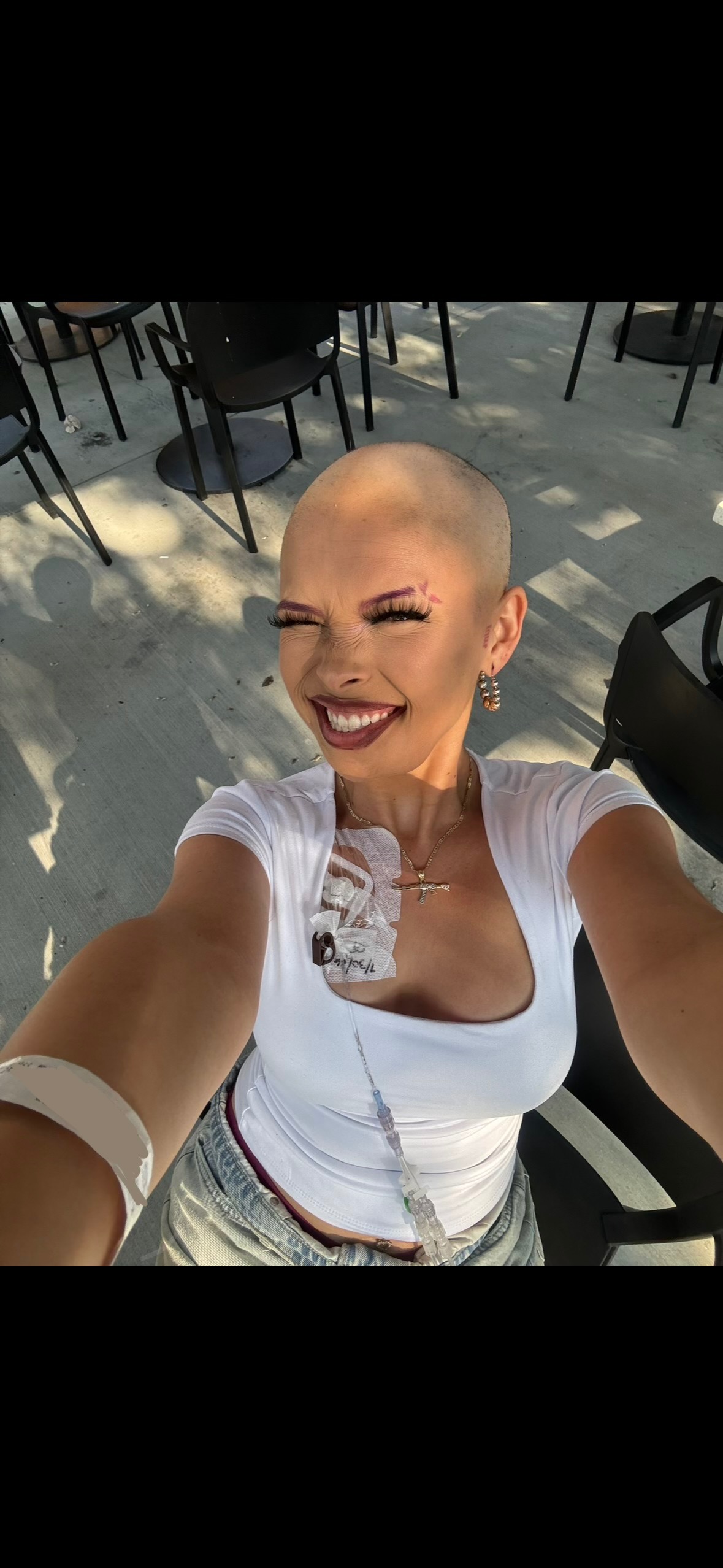 Support Alexandra’s Battle With Bone Cancer campaign photo, 2 of 8
