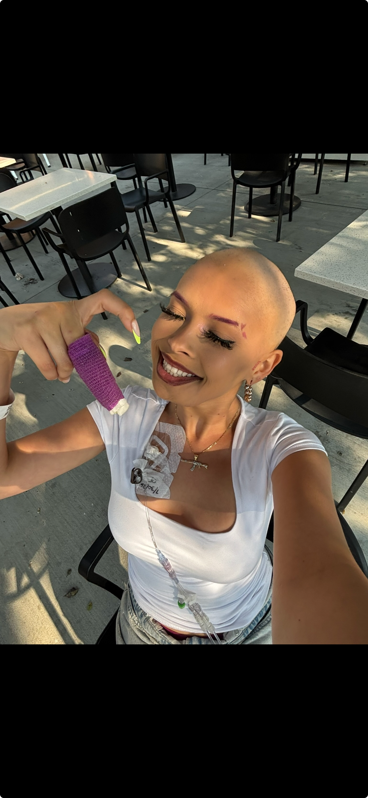 Support Alexandra’s Battle With Bone Cancer campaign photo, 4 of 8