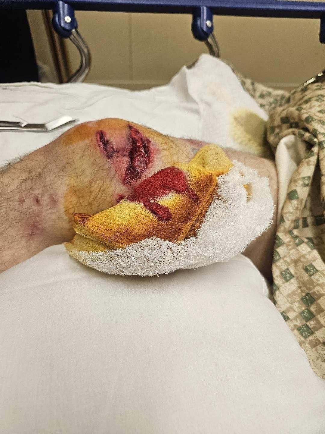 Support Tim's Recovery Journey campaign photo, 6 of 7