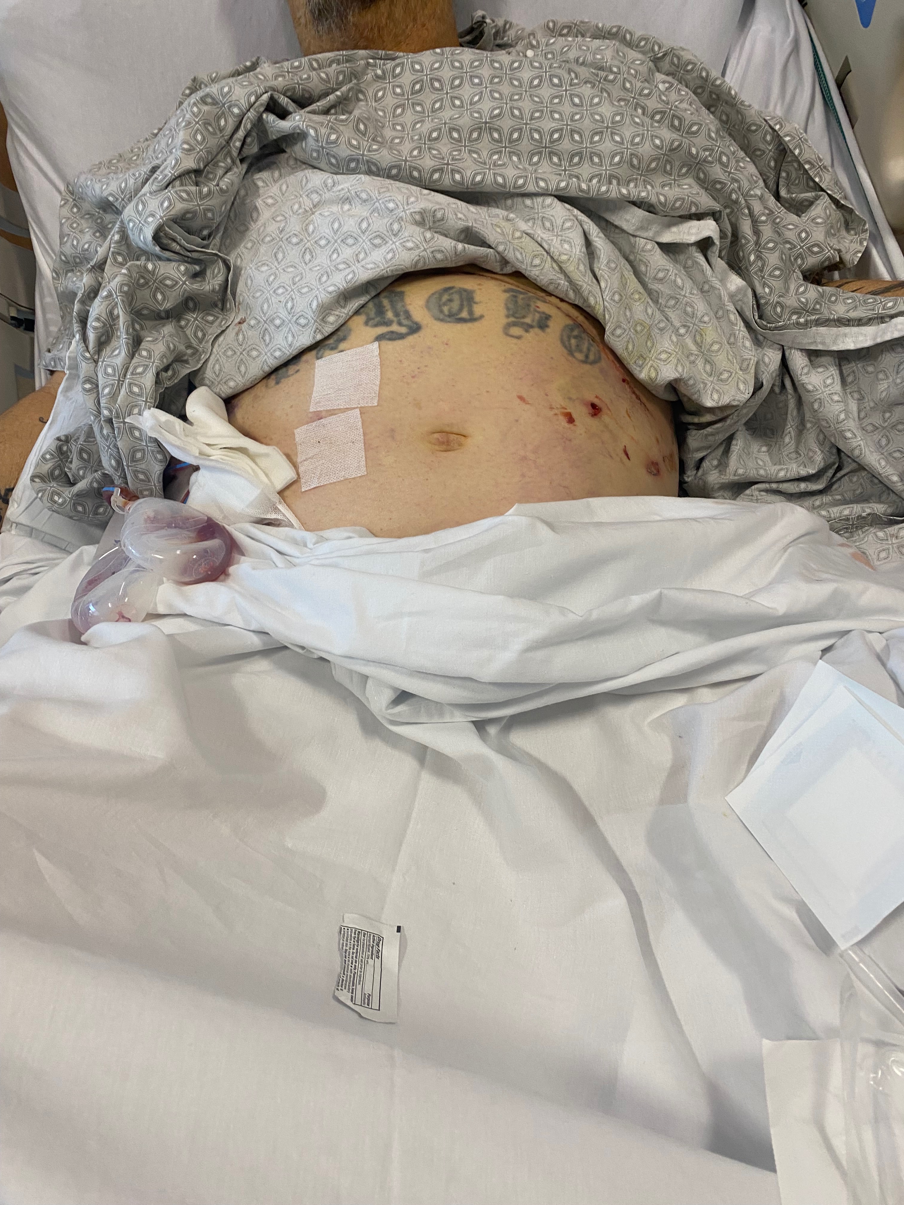 Support Donnie Caulder Jr.'s Liver Transplant Recovery campaign photo, 4 of 5