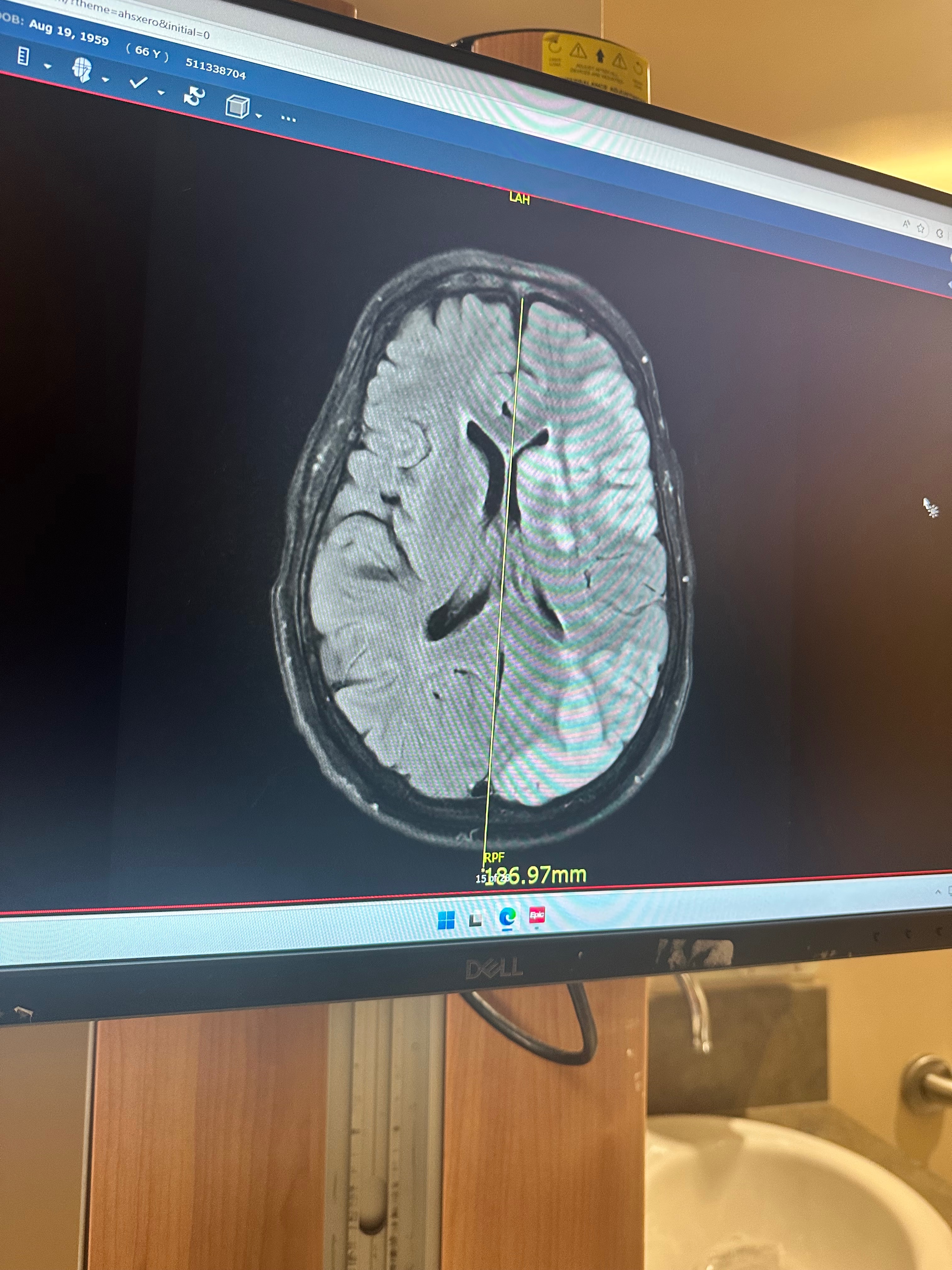 Help my mom’s stroke recovery process. campaign photo, 5 of 7