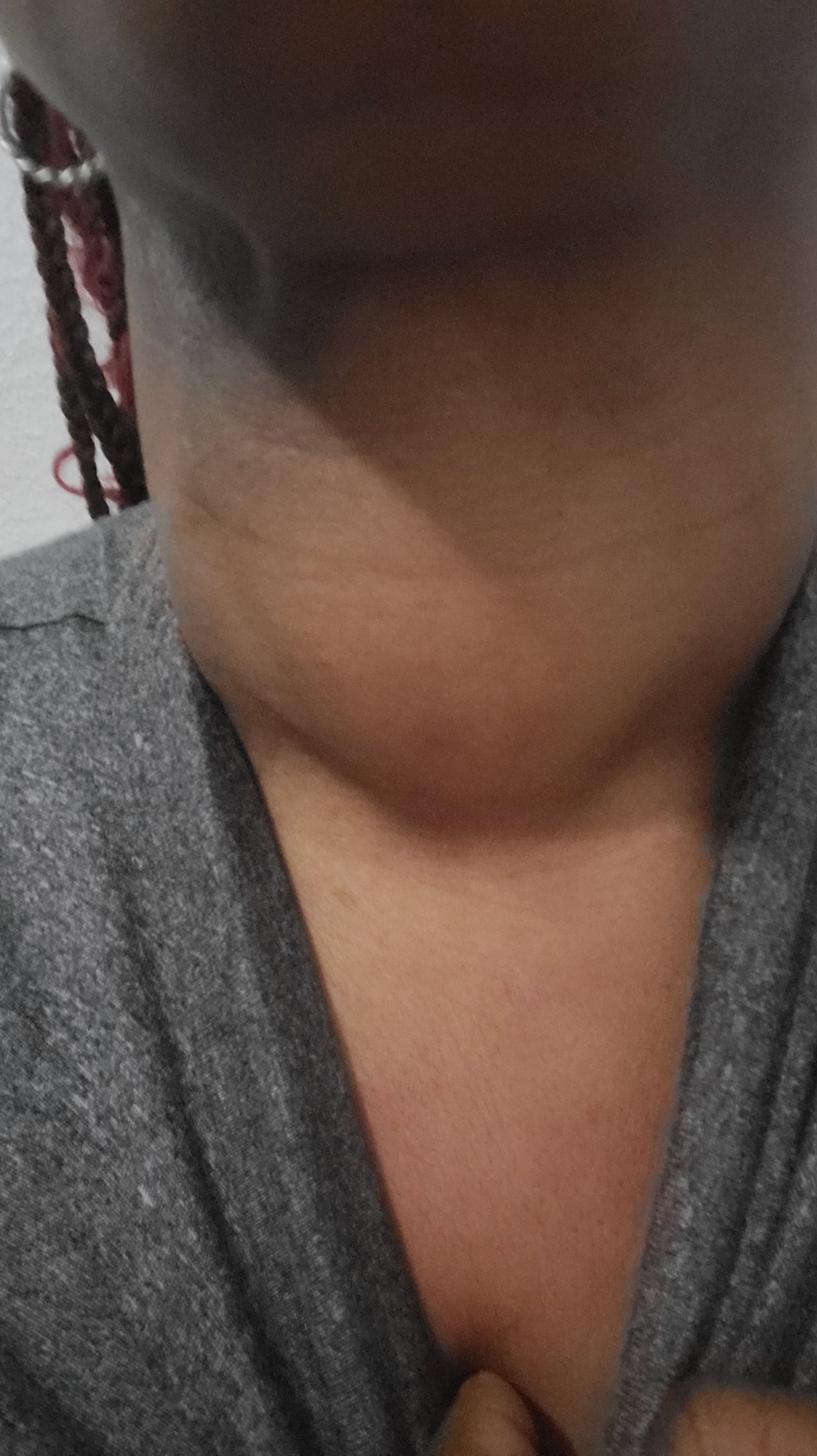 Support Shantell Johnson's Fight for Health campaign photo, 4 of 7