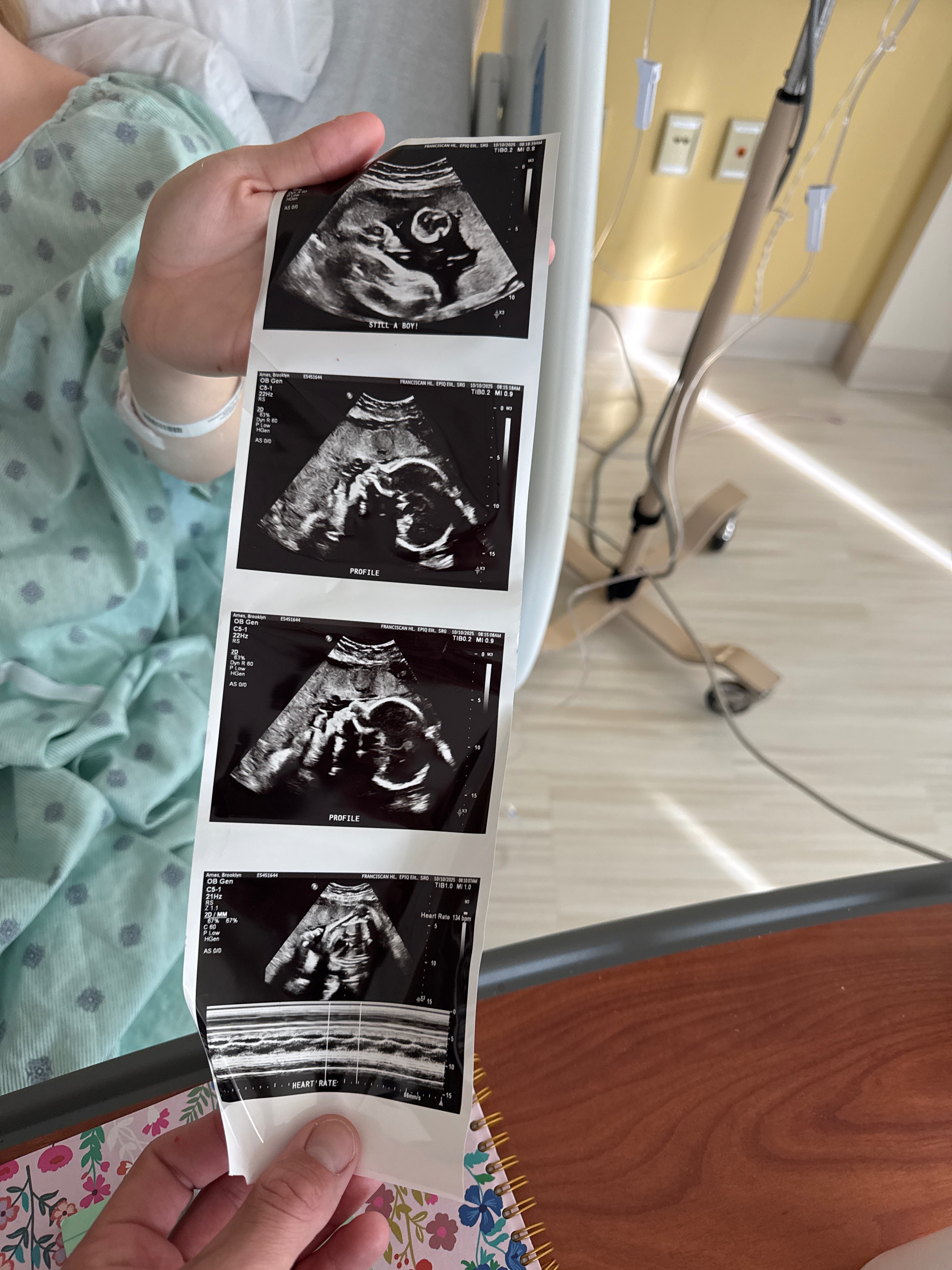 Our baby boy will be here earlier than expected. campaign photo, 4 of 5