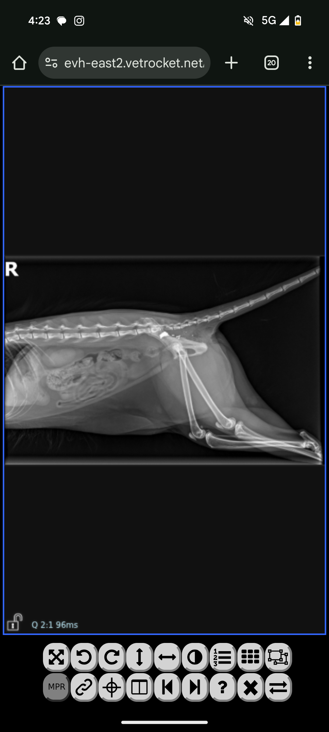 Help Erza survive shot wound campaign photo, 4 of 7
