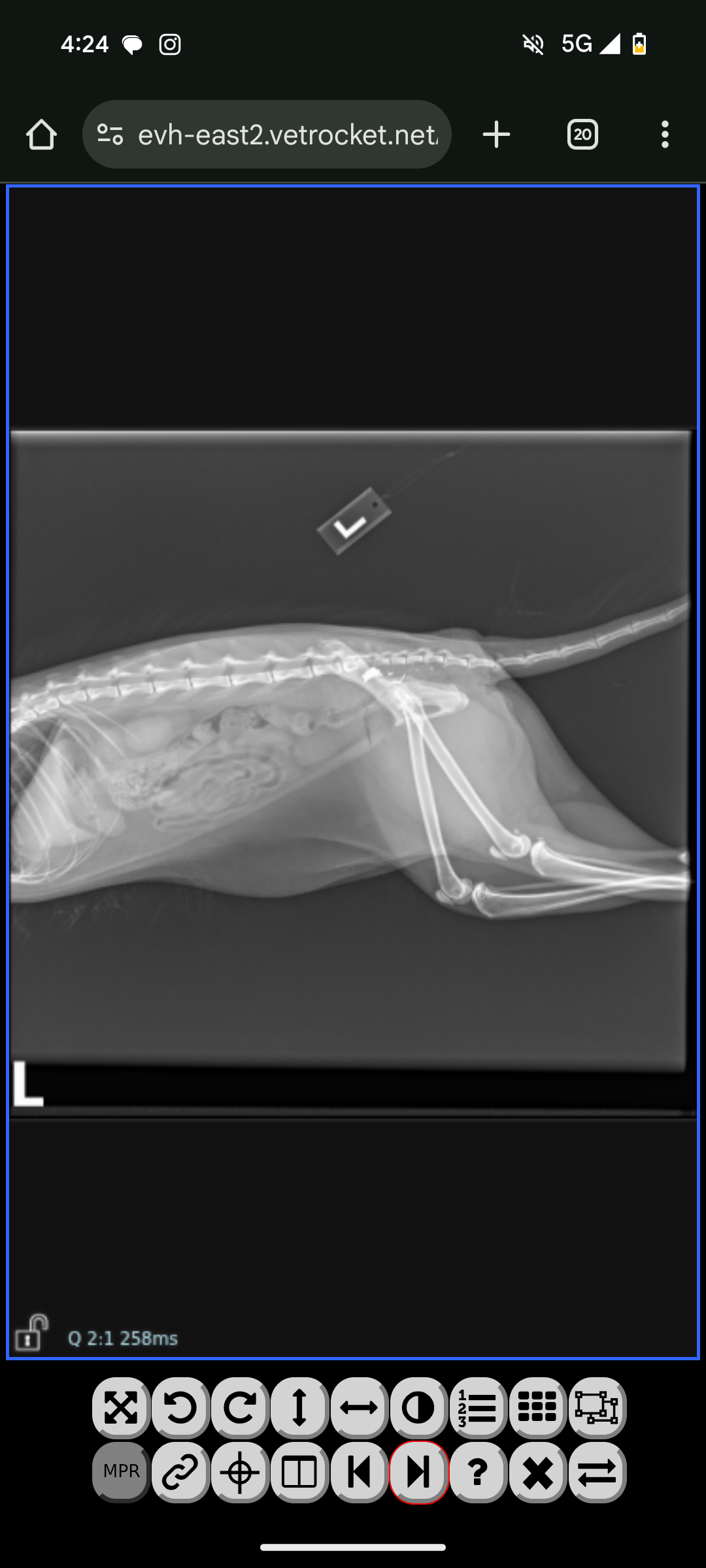 Help Erza survive shot wound campaign photo, 5 of 7