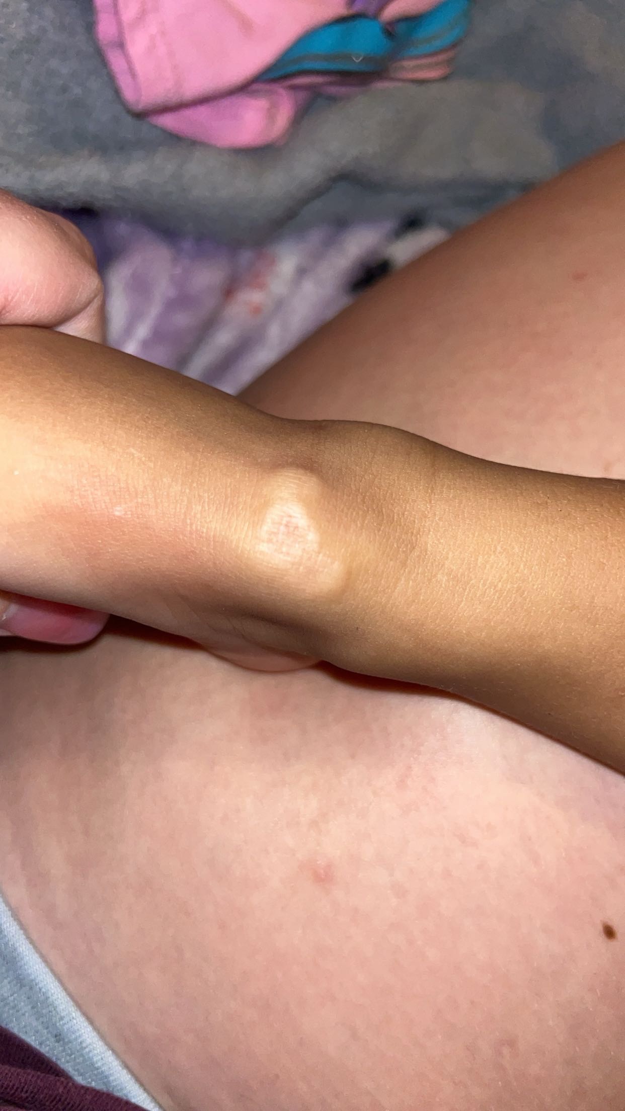 Help Brielle Achieve a Healthy Gut campaign photo, 5 of 7