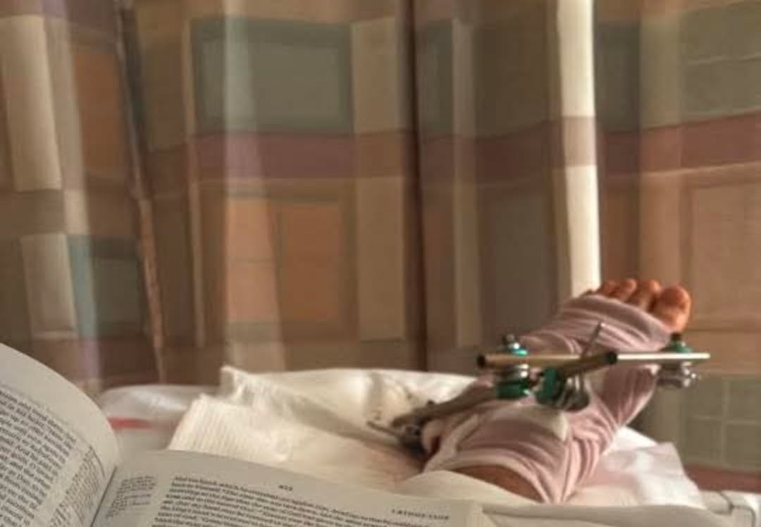 Help Brian McCauley Heal After a Serious Motorcycle Accident campaign photo, 2 of 8