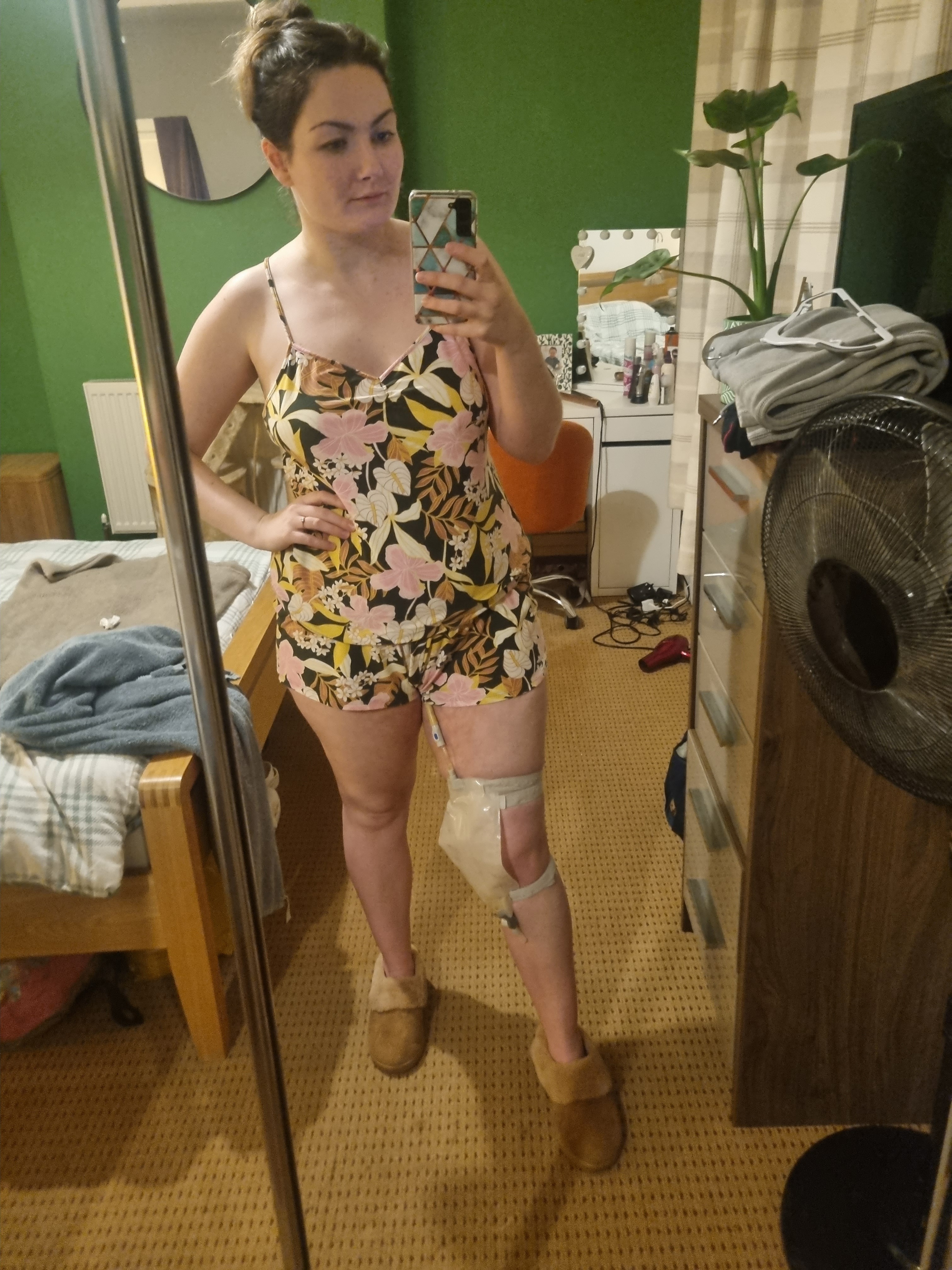Life Changing Endometriosis Surgery campaign photo, 5 of 8