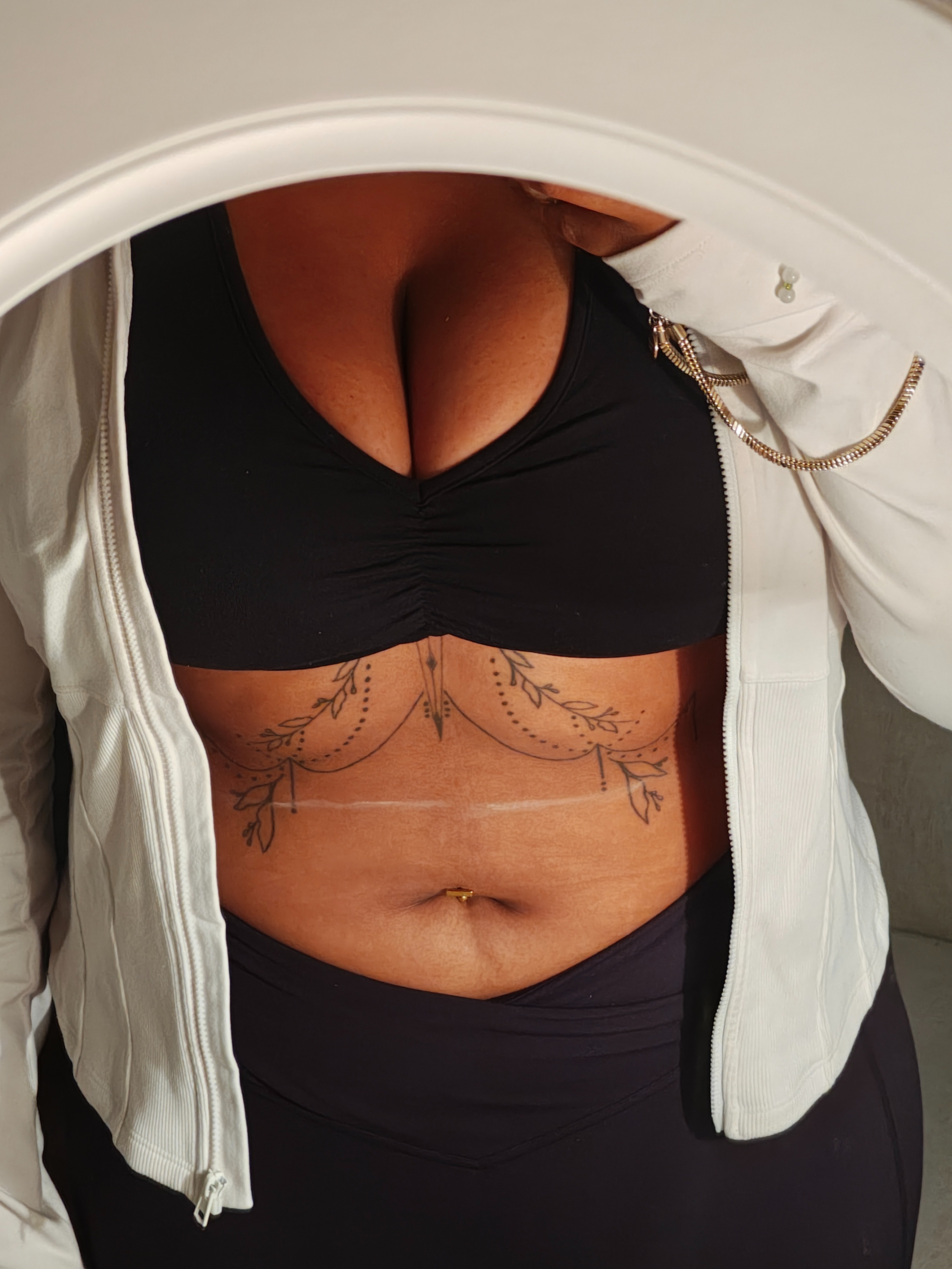 Help Nirvana Get a Life-Changing Breast Lift campaign photo, 7 of 8