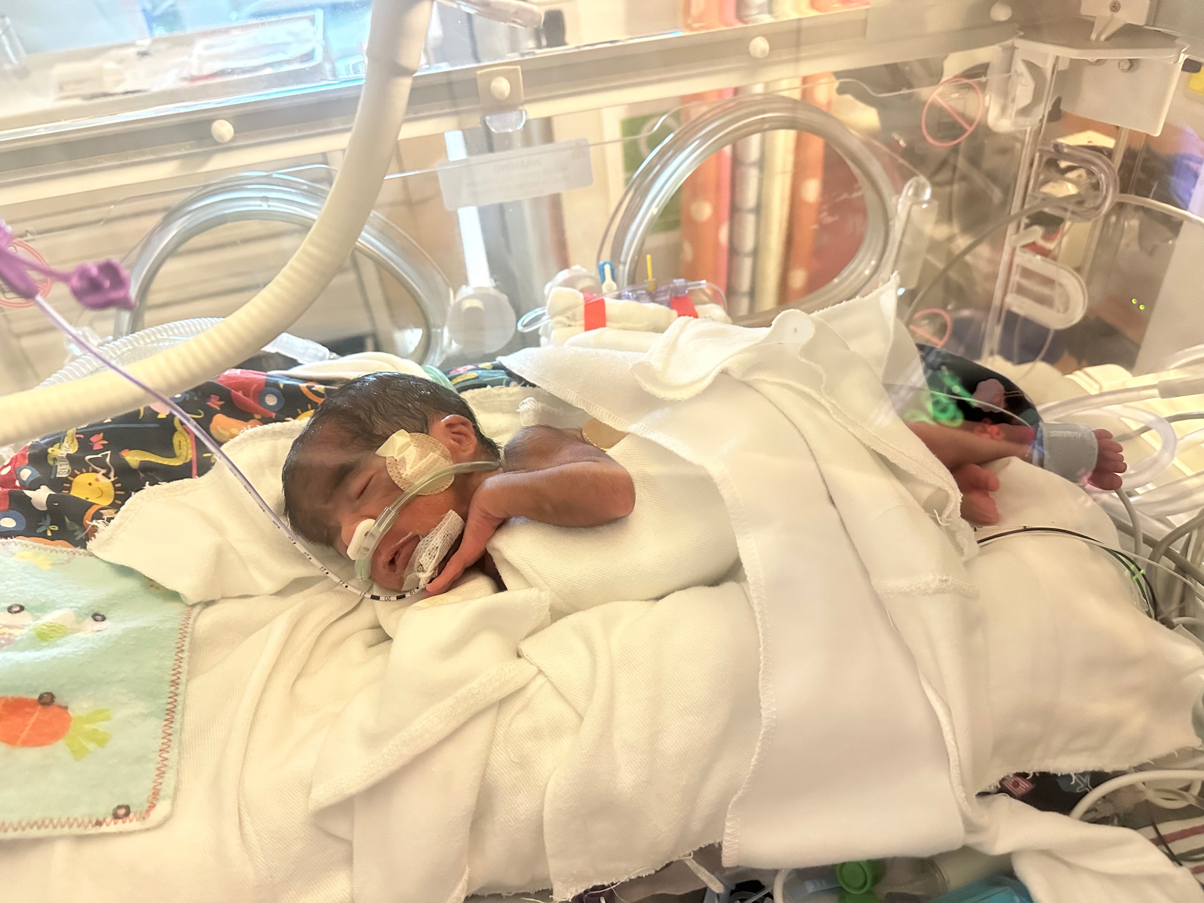 Support Axel Espinoza's NICU Journey campaign photo, 5 of 8
