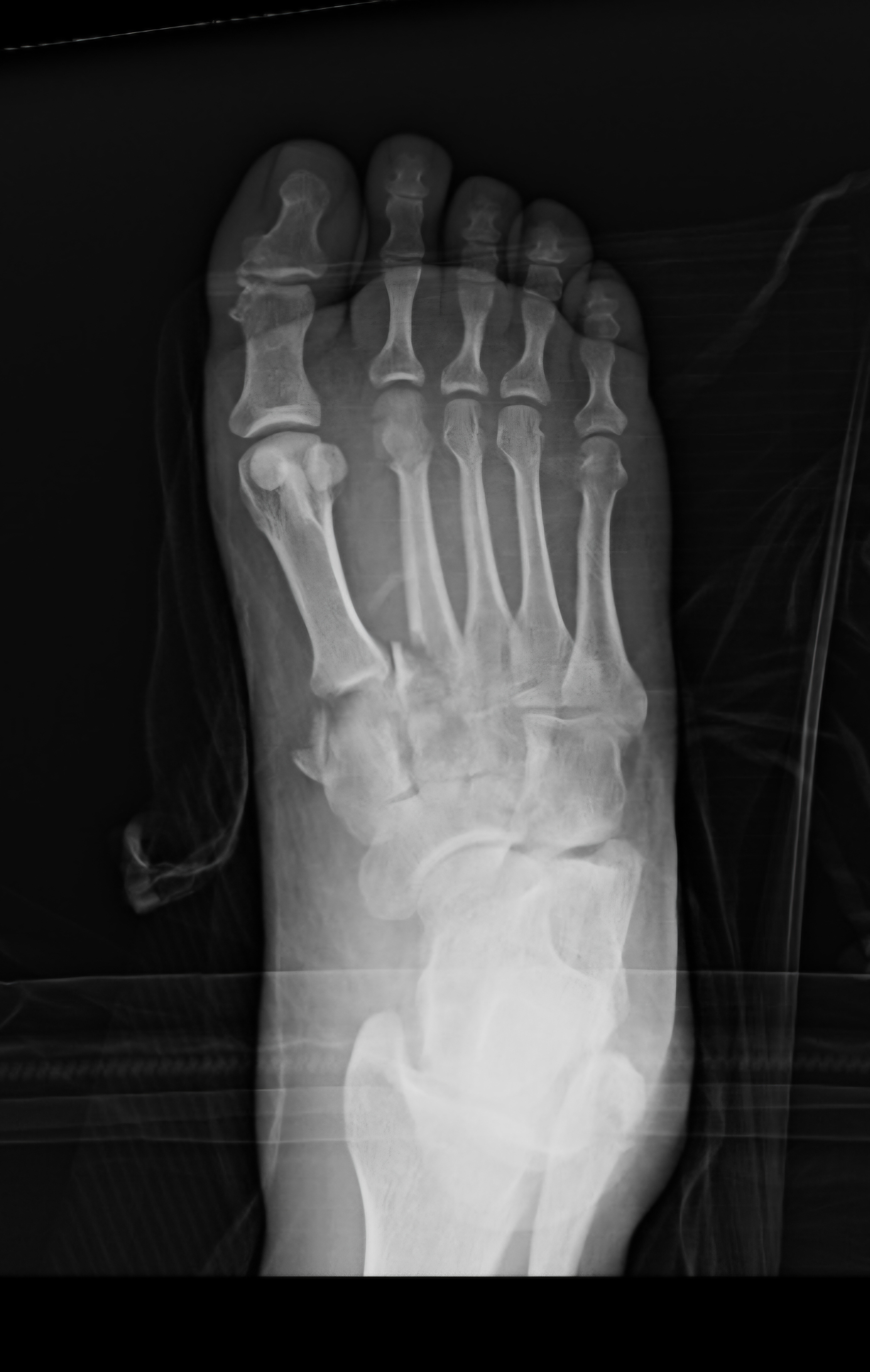 Aid Bryce's(Shadow's) Recovery After a Devastating Accident campaign photo, 5 of 8