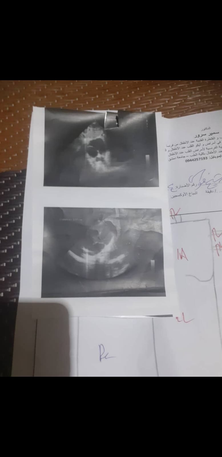 Dringende Herz OP für meinen 5 jährigen Neffen campaign photo, 7 of 8