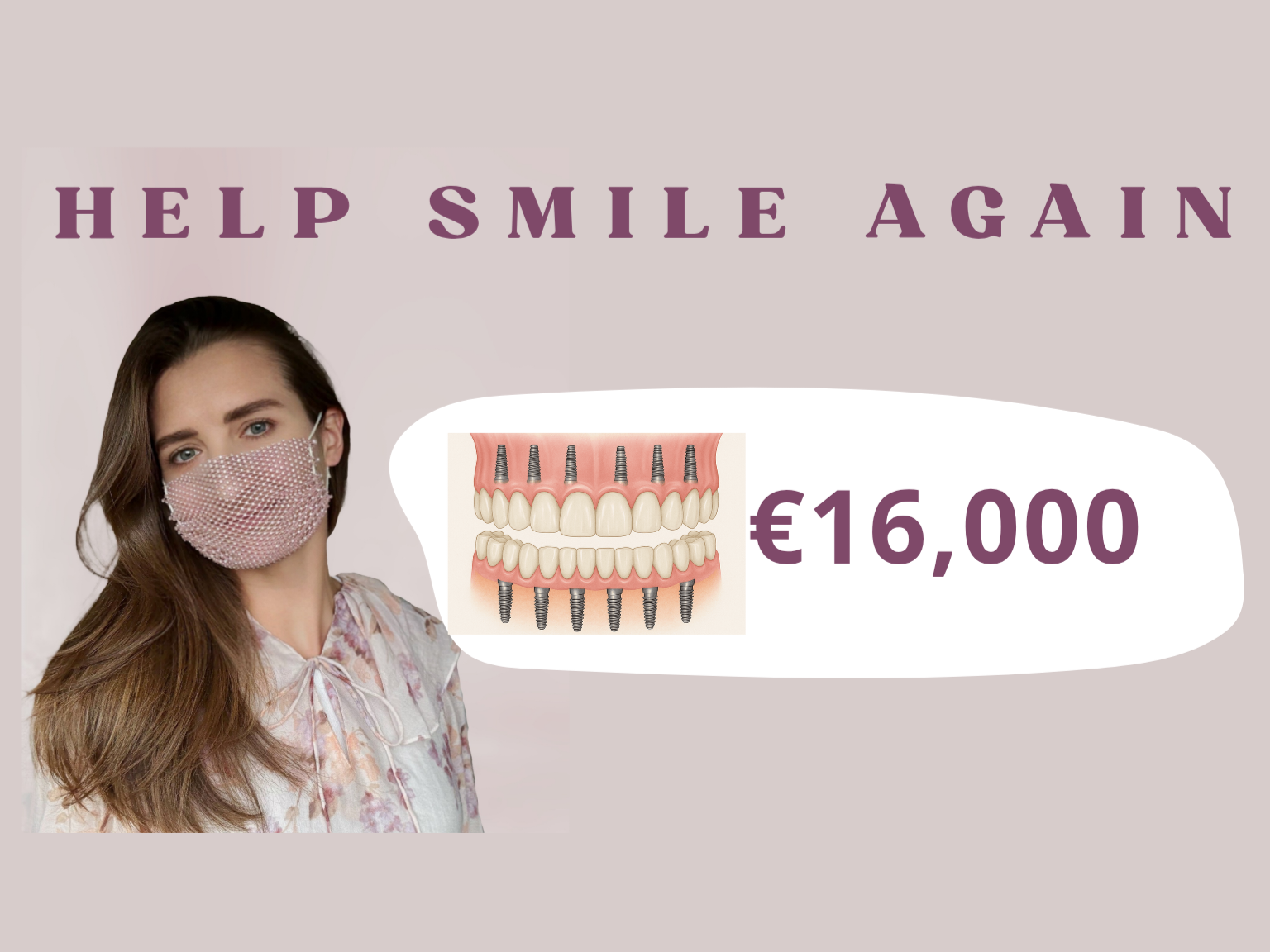 Assistance with implant  placement after bone grafting campaign photo, 7 of 8