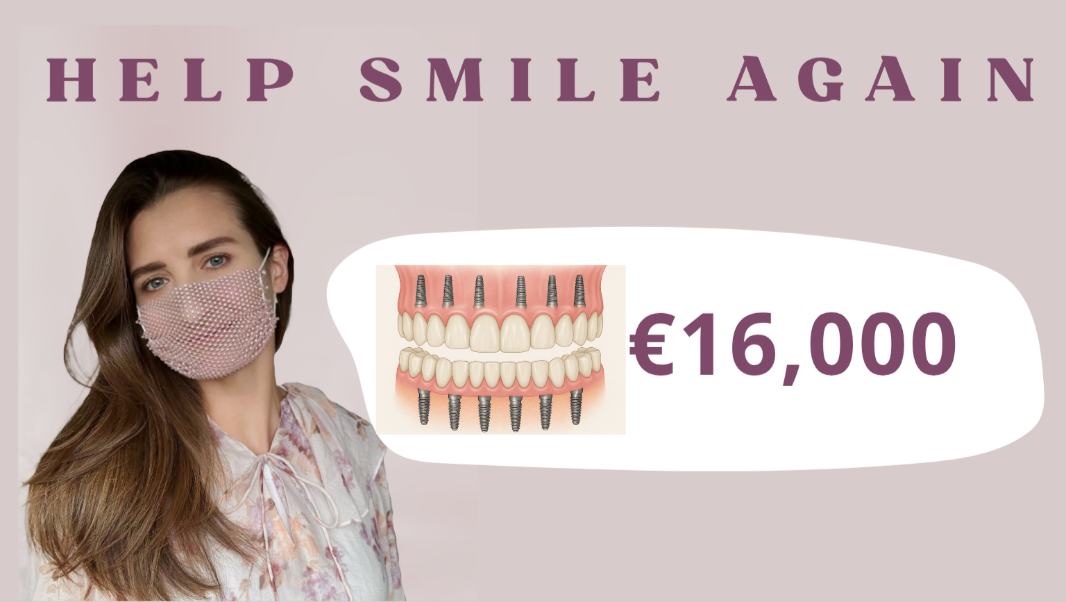 Assistance with implant placement after bone grafting photo