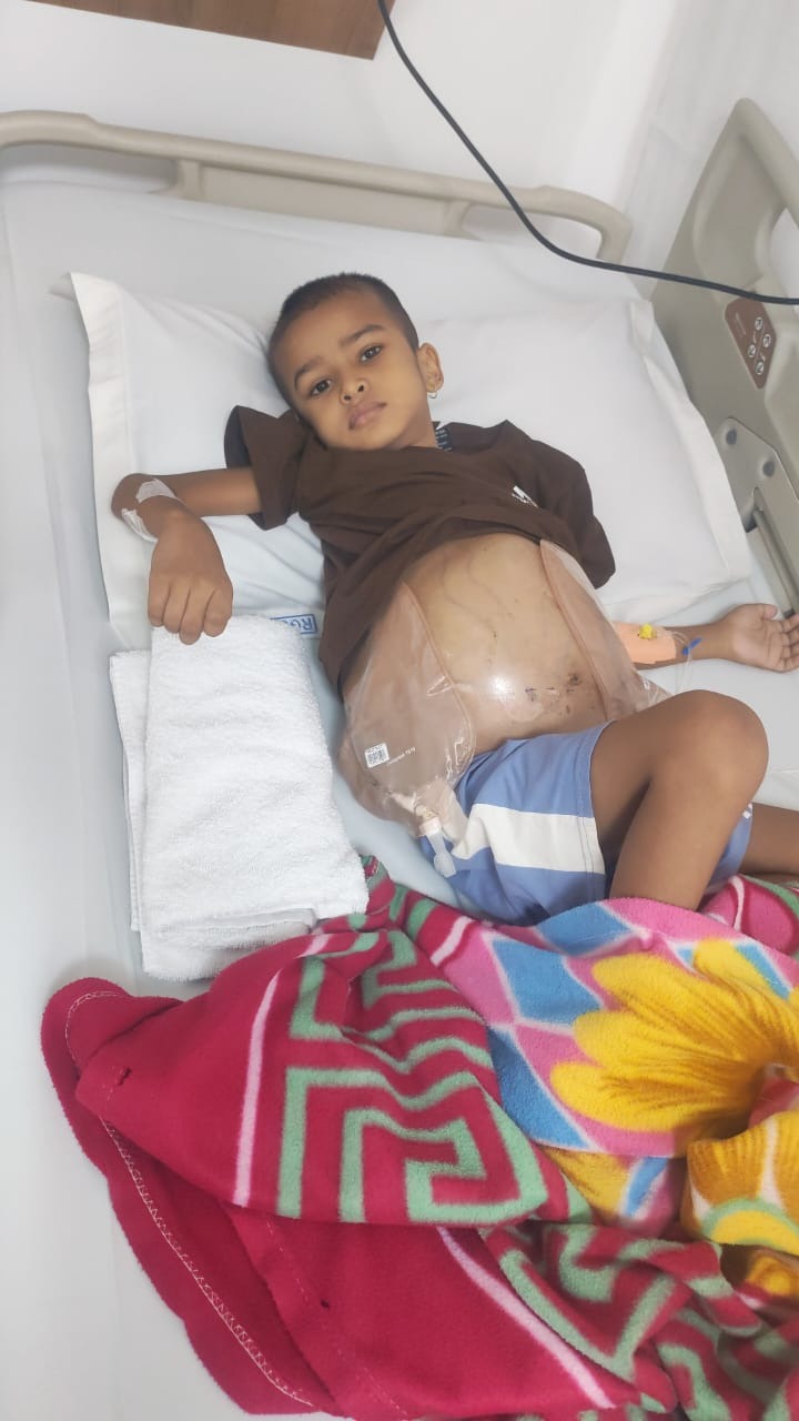 Help 6-Year-Old Prajwal Fight Cancer campaign photo, 7 of 8